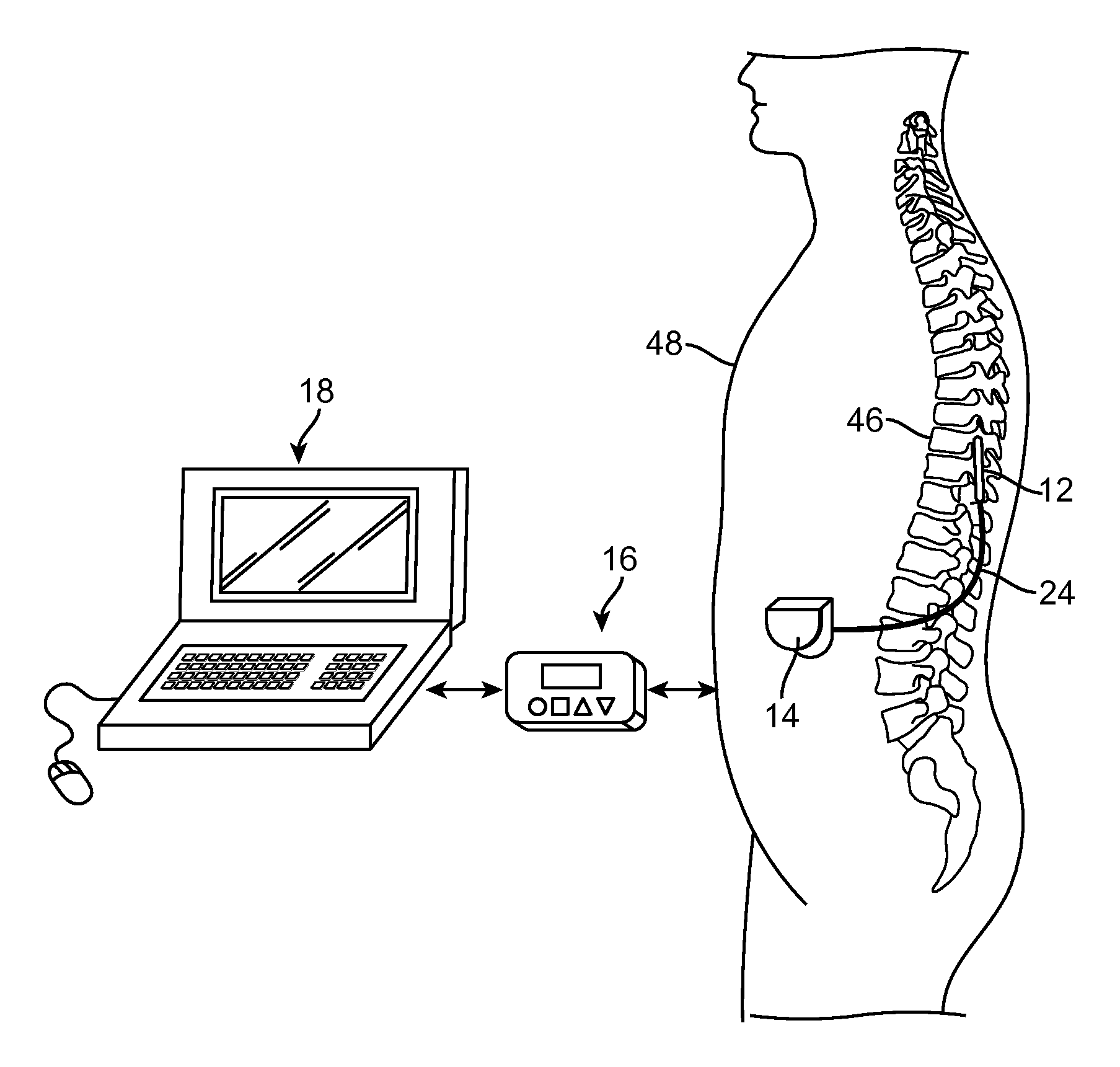 Neuromodulation system and method for reducing energy requirements using feedback