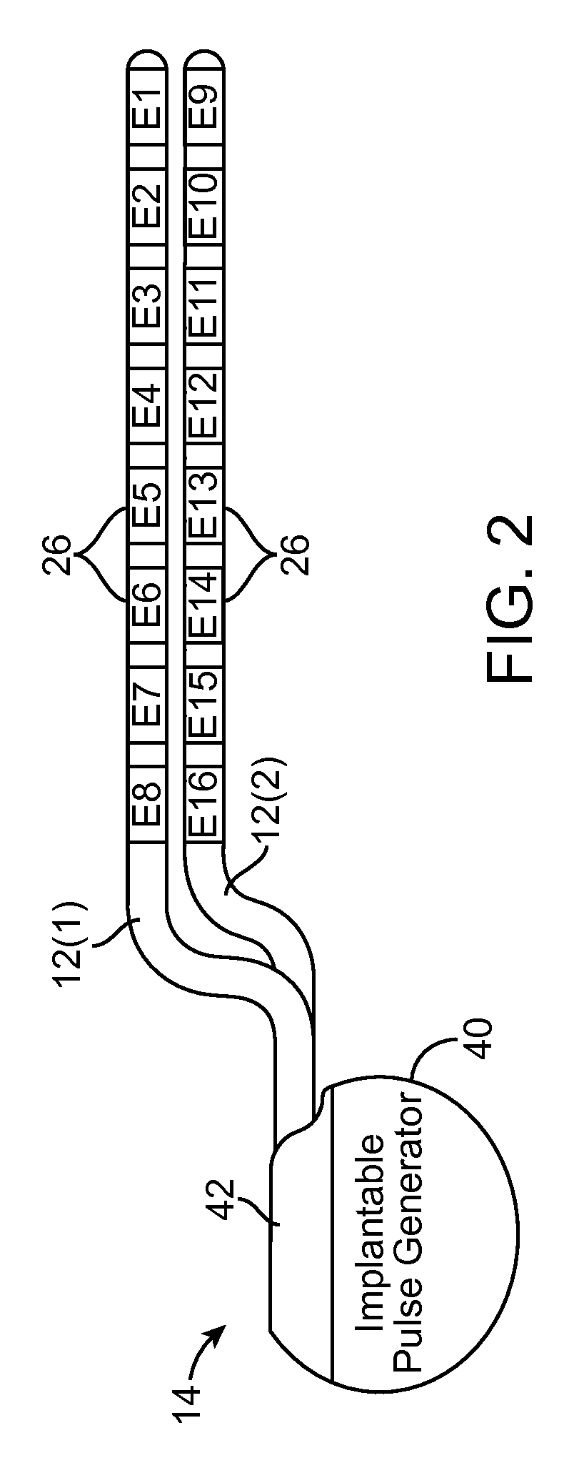 Neuromodulation system and method for reducing energy requirements using feedback