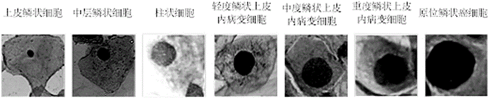 Cervix uteri single cell image segmentation algorithm