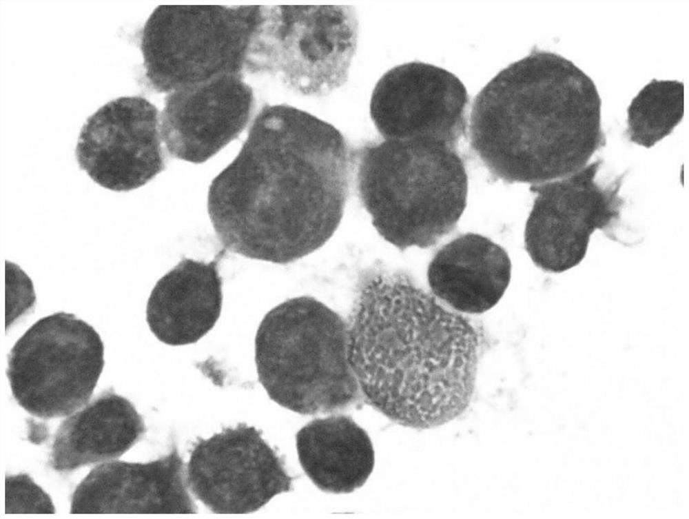 Human primary myelofibrosis cell strain and application thereof