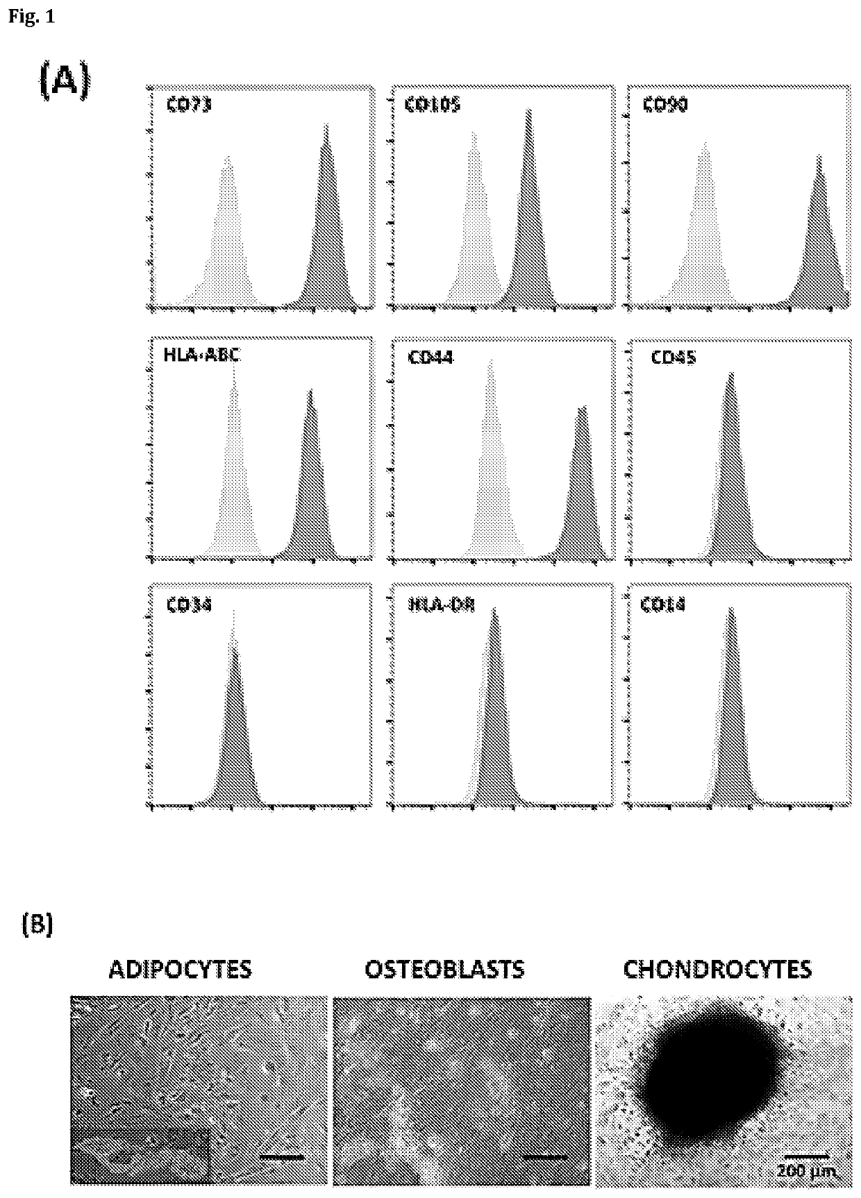 Anti-angiogenic therapy based on exosomes derived from menstrual stem cells