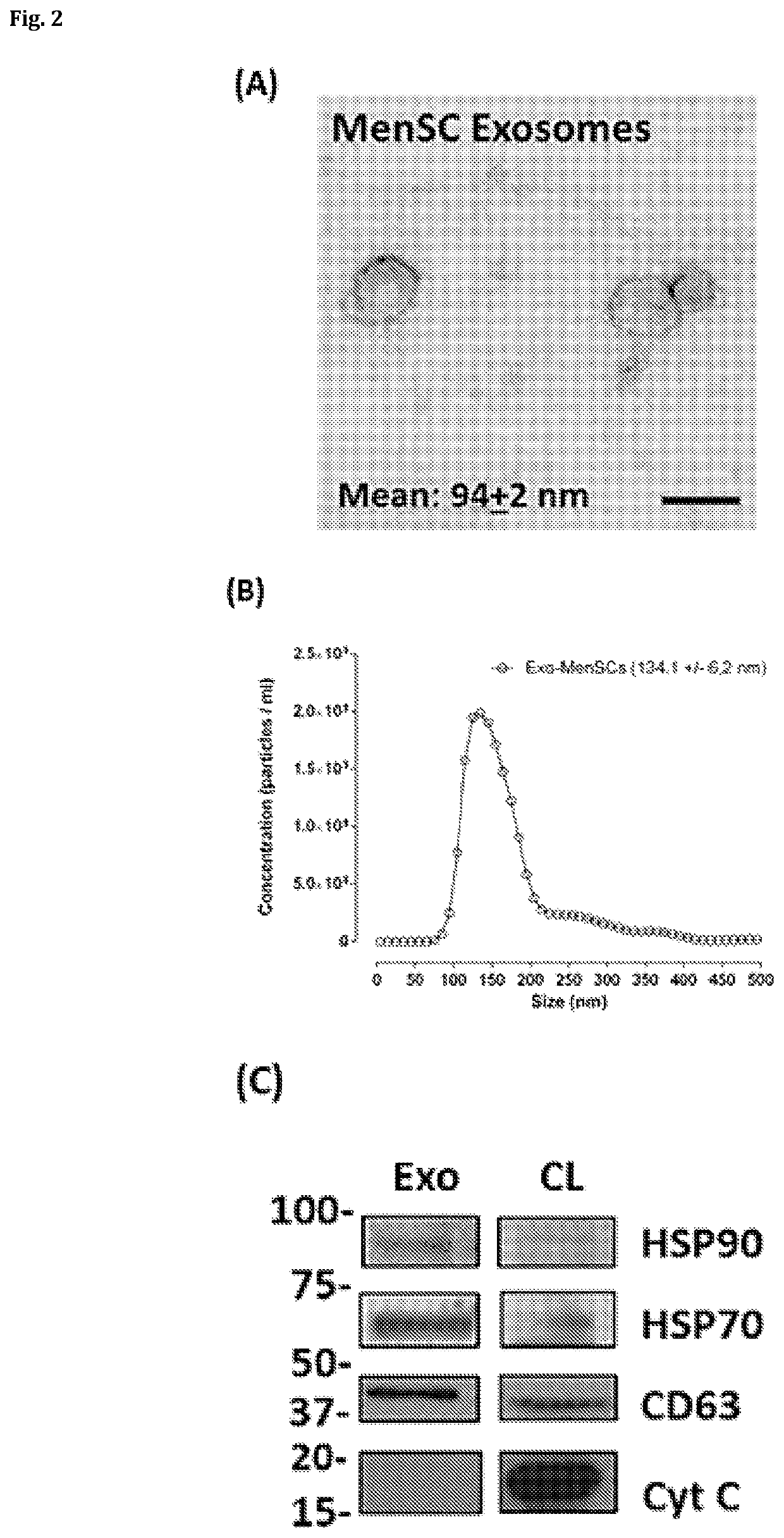 Anti-angiogenic therapy based on exosomes derived from menstrual stem cells