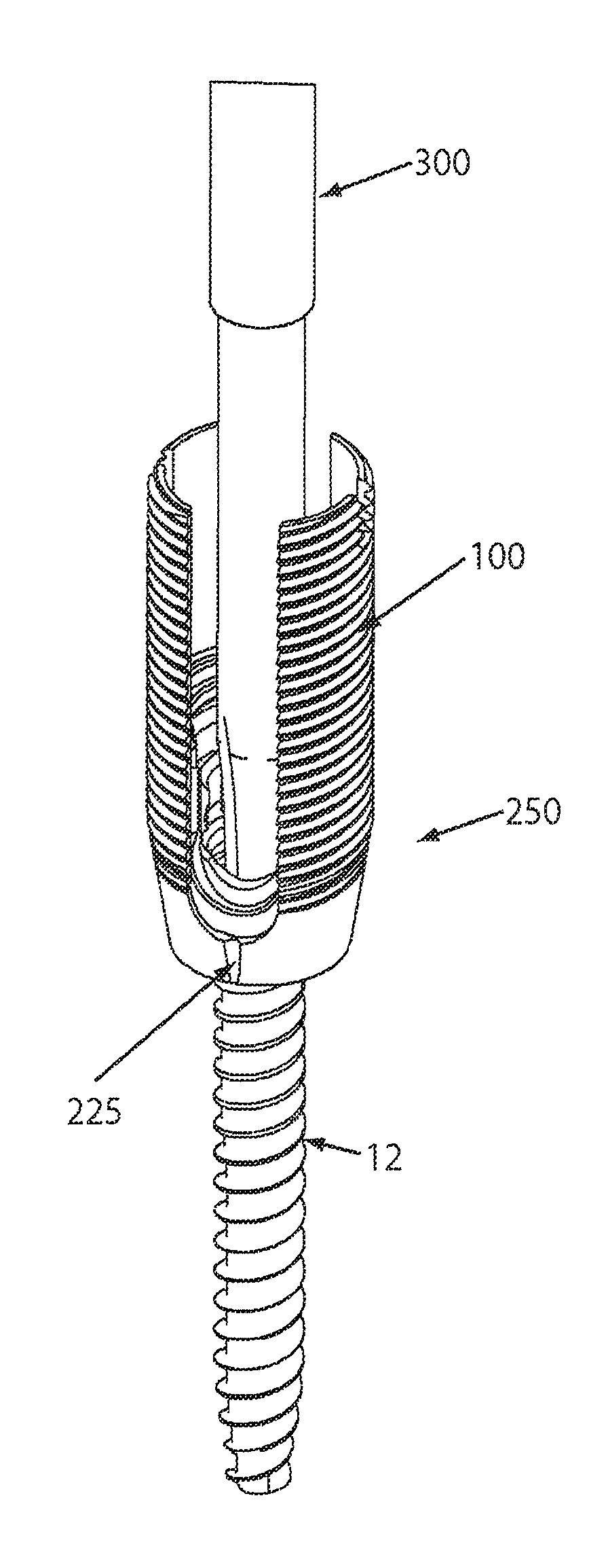 Reduction sleeve