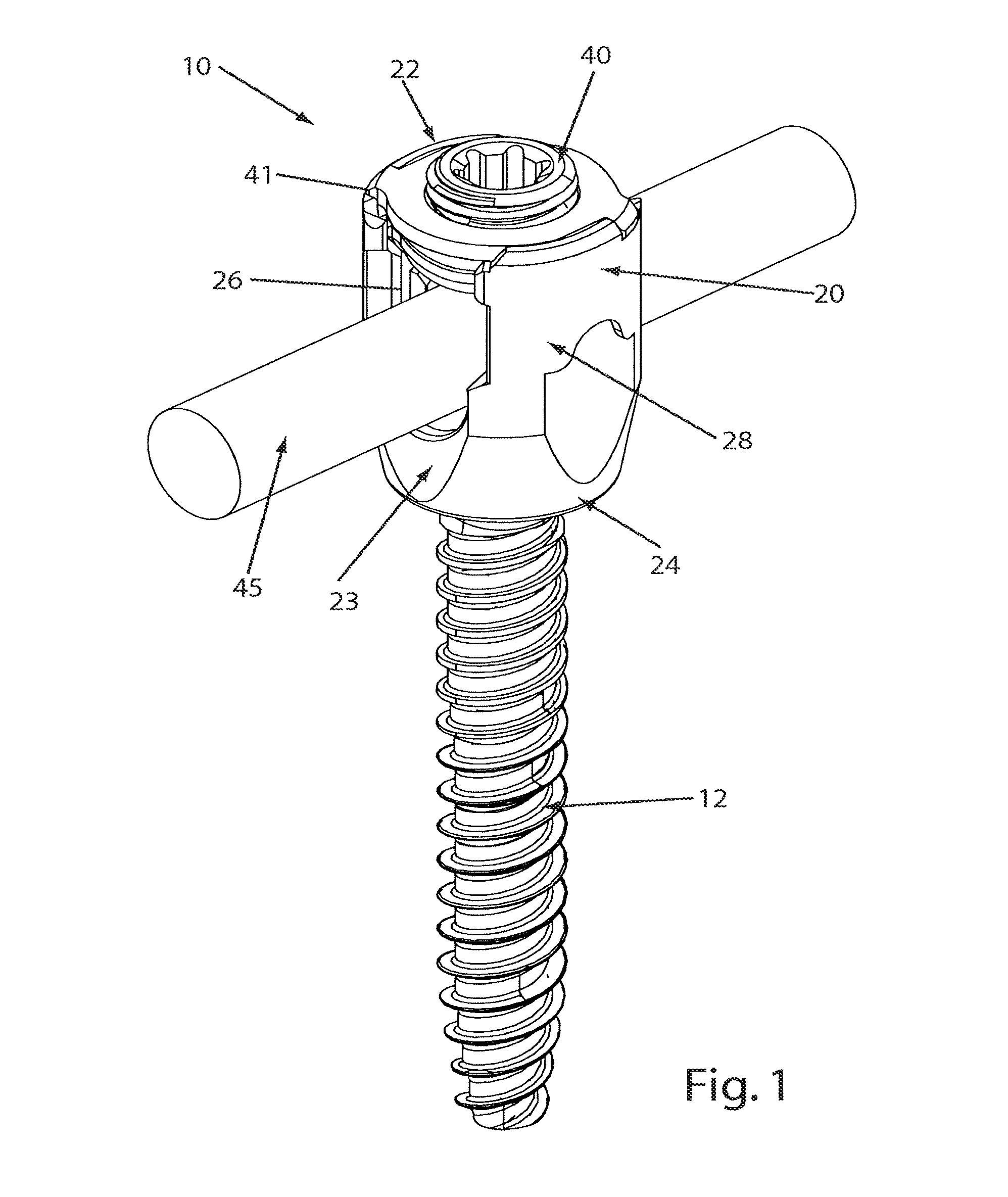 Reduction sleeve