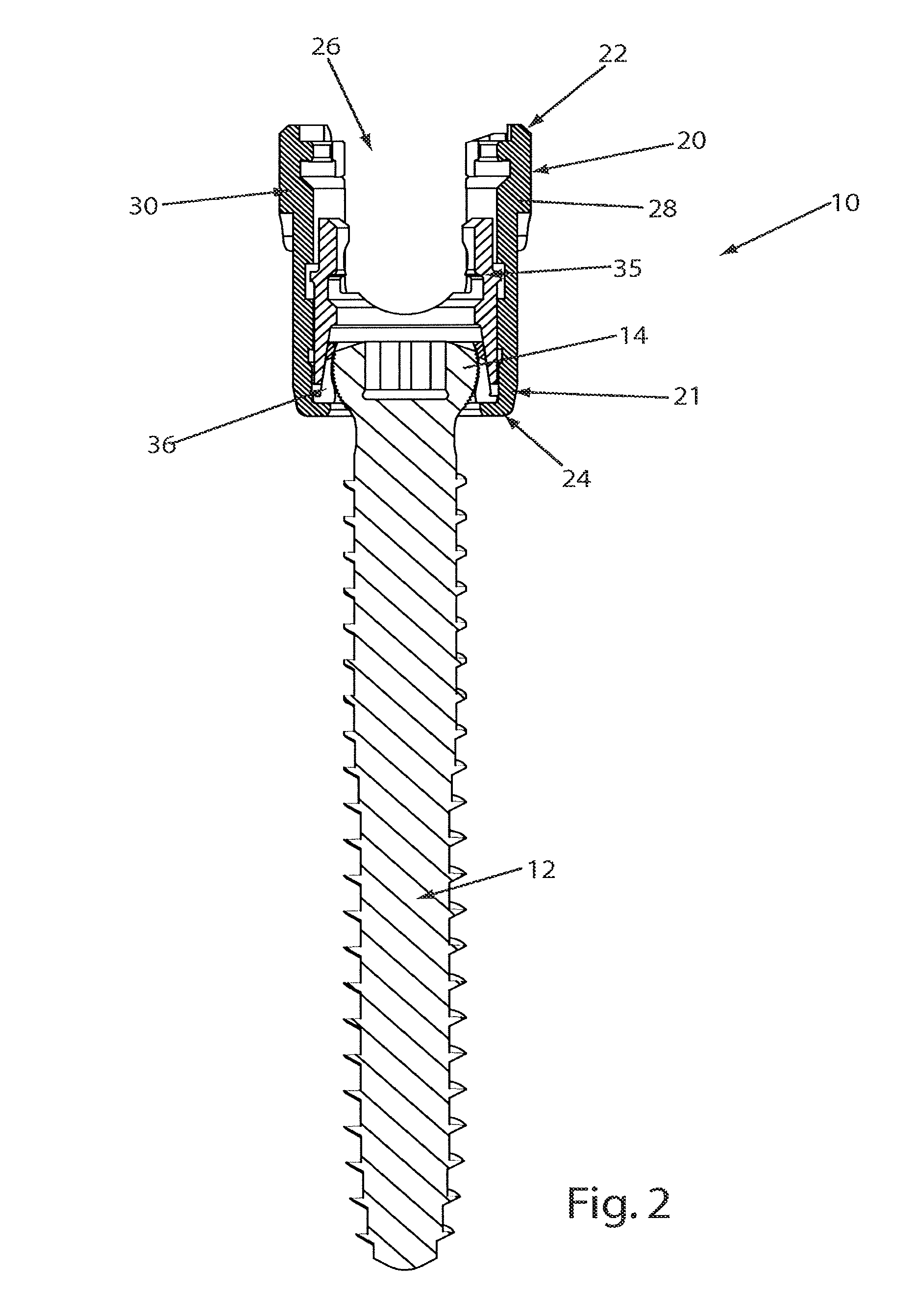 Reduction sleeve