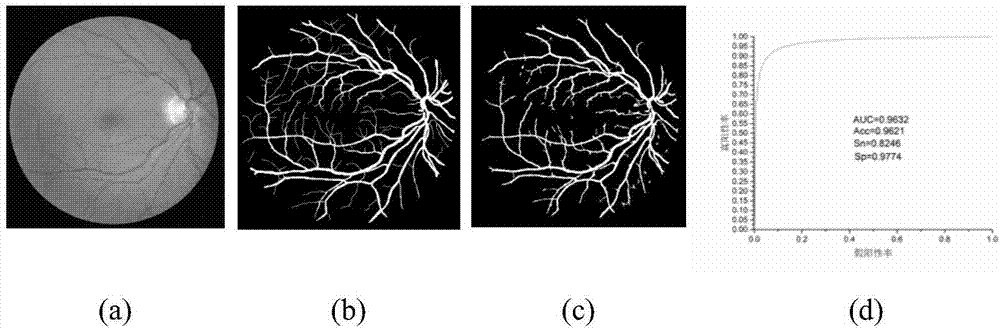 ELM-based fundus image retinal vessel segmentation method