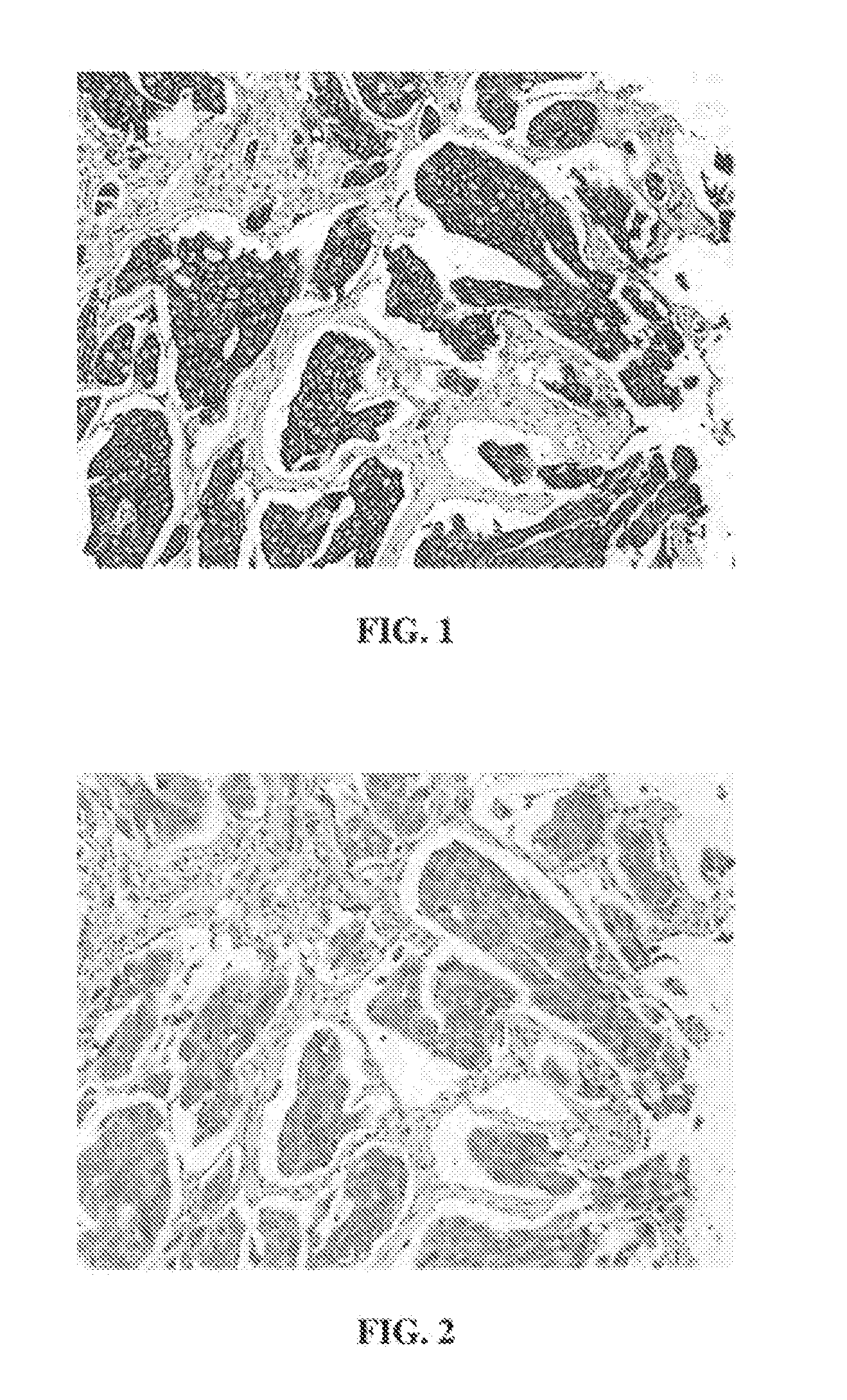 Anti-Uroplakin II Antibodies Systems and Methods