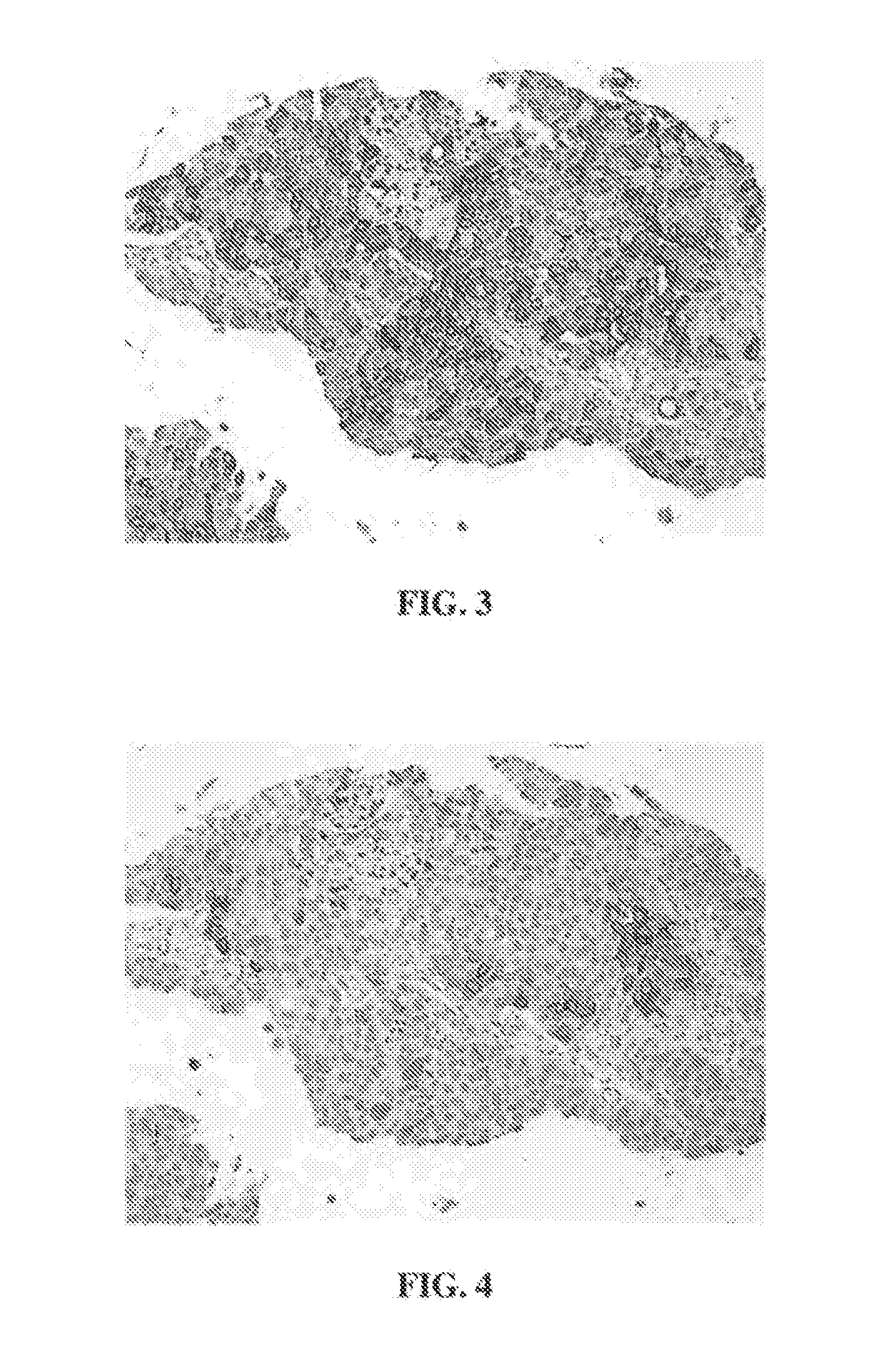 Anti-Uroplakin II Antibodies Systems and Methods