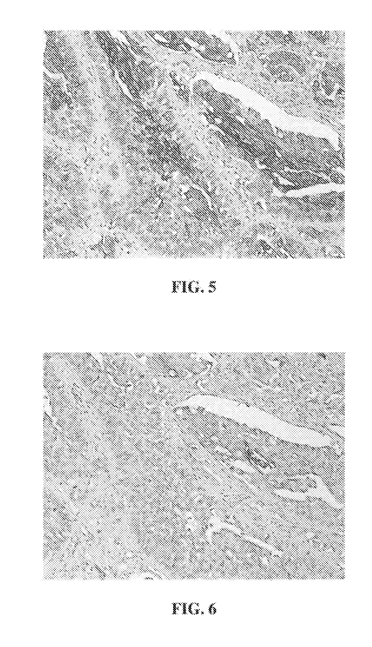 Anti-Uroplakin II Antibodies Systems and Methods