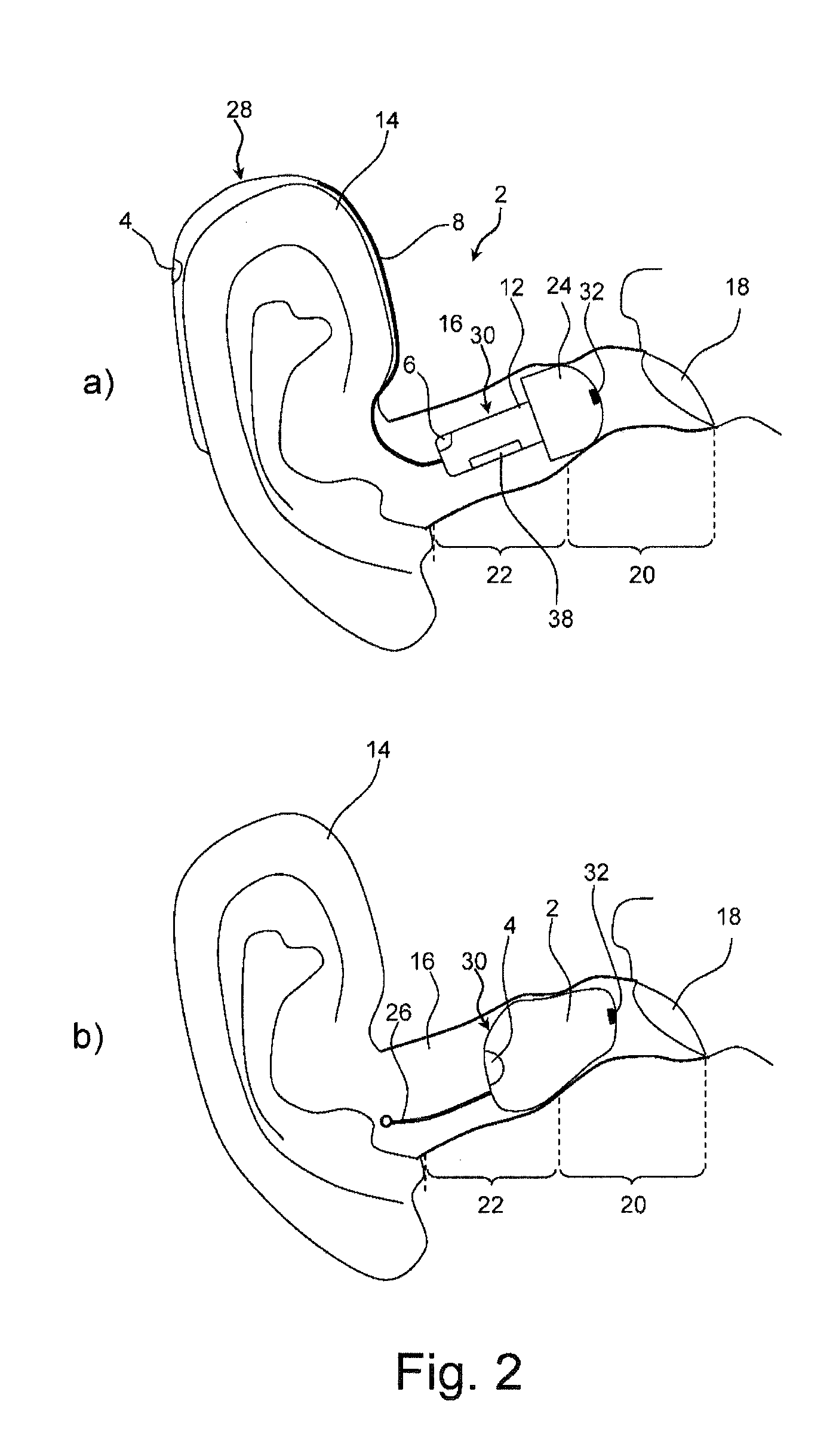 Hearing aid device and method for feedback reduction