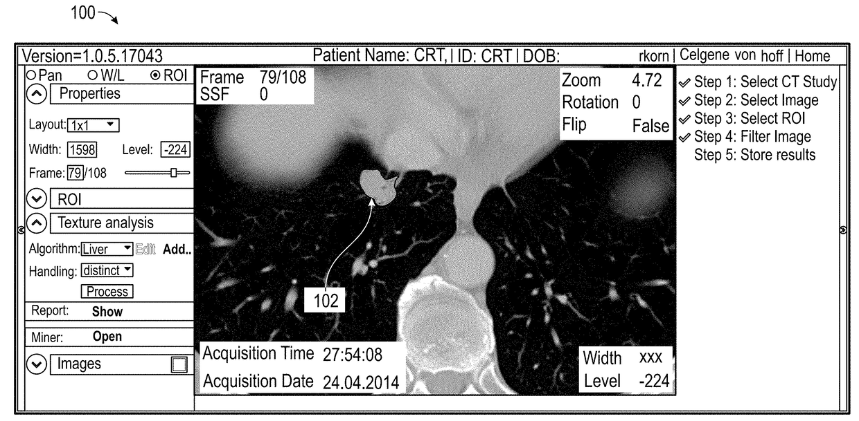 Systems and Methods For Predicting Lung Cancer Immune Therapy Responsiveness Using Quantitative Textural Analysis