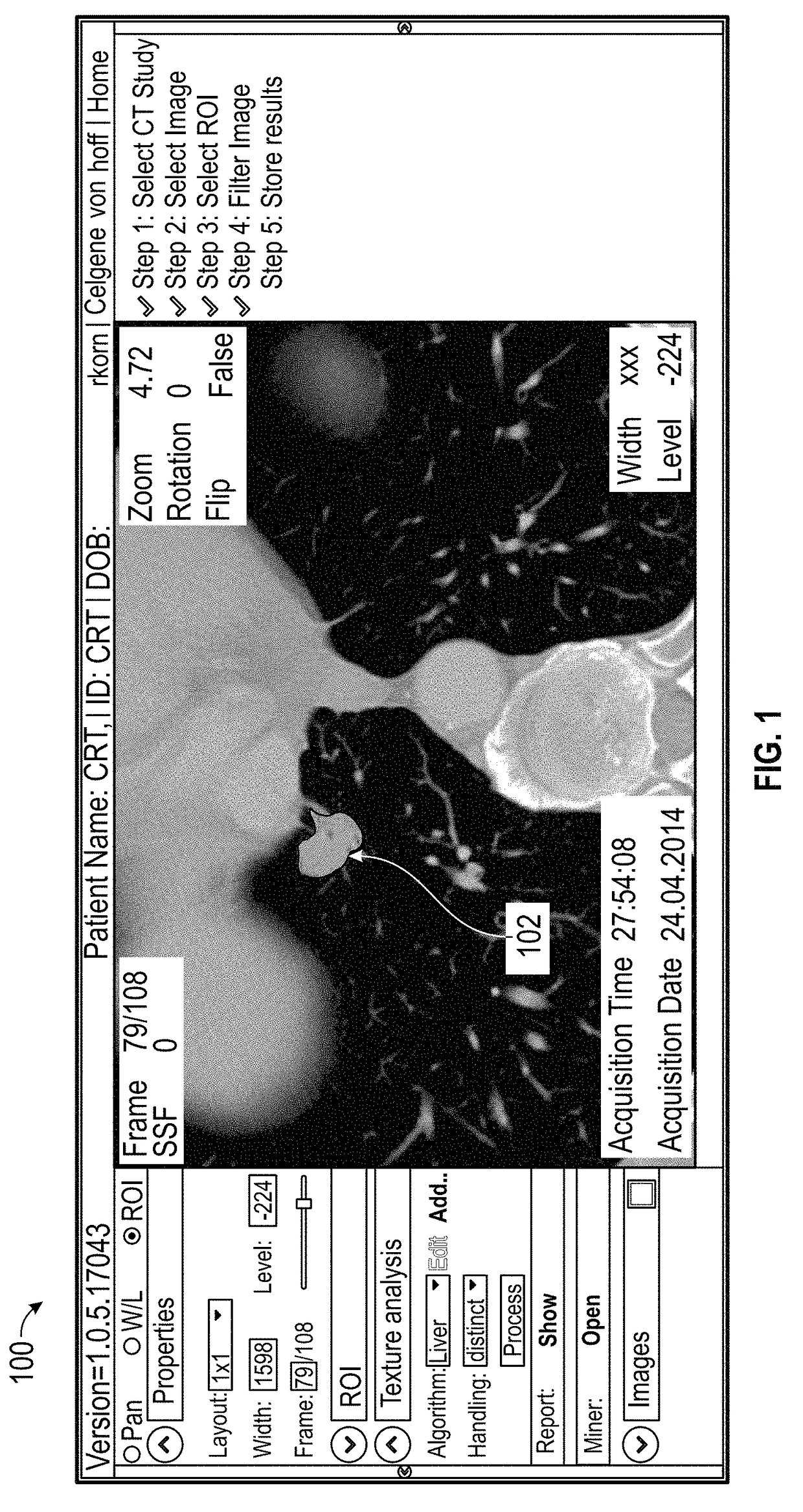 Systems and Methods For Predicting Lung Cancer Immune Therapy Responsiveness Using Quantitative Textural Analysis