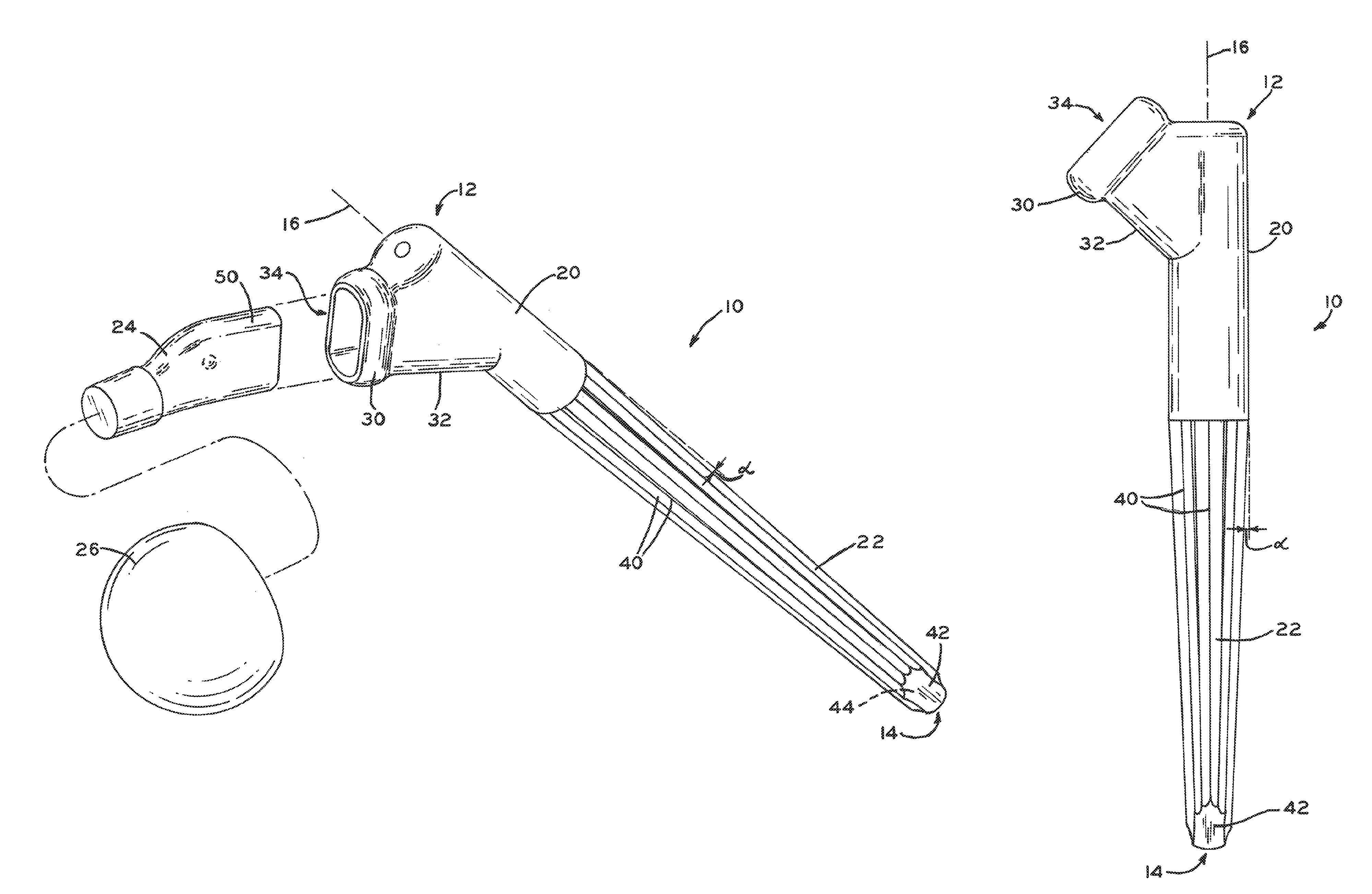 Modular revision femoral prosthesis