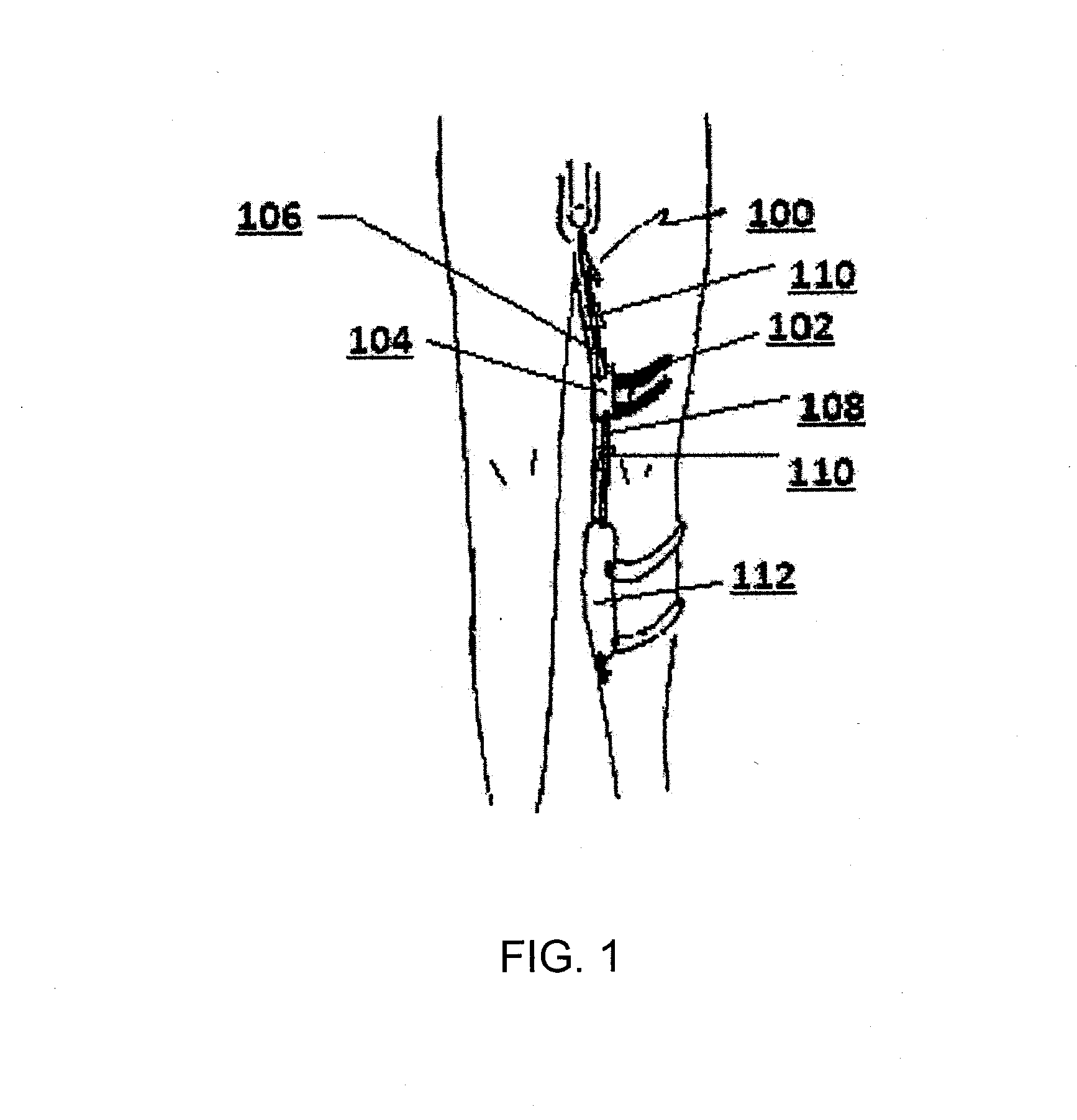 Medical tubing and catheter control