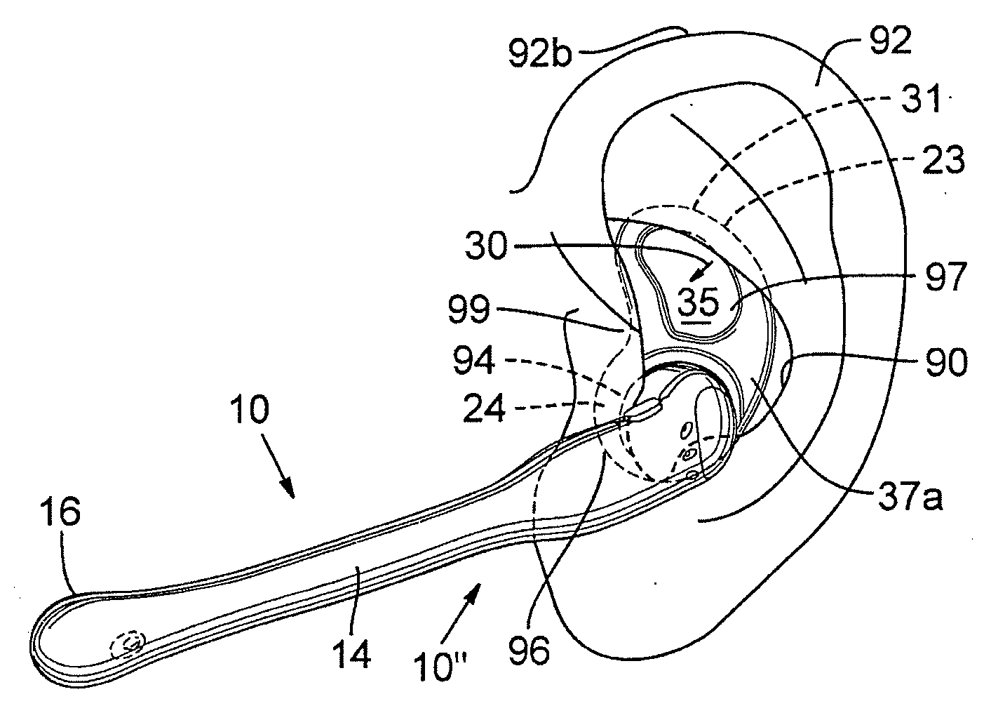 Antihelix-conforming ear-mount for personal audio-set