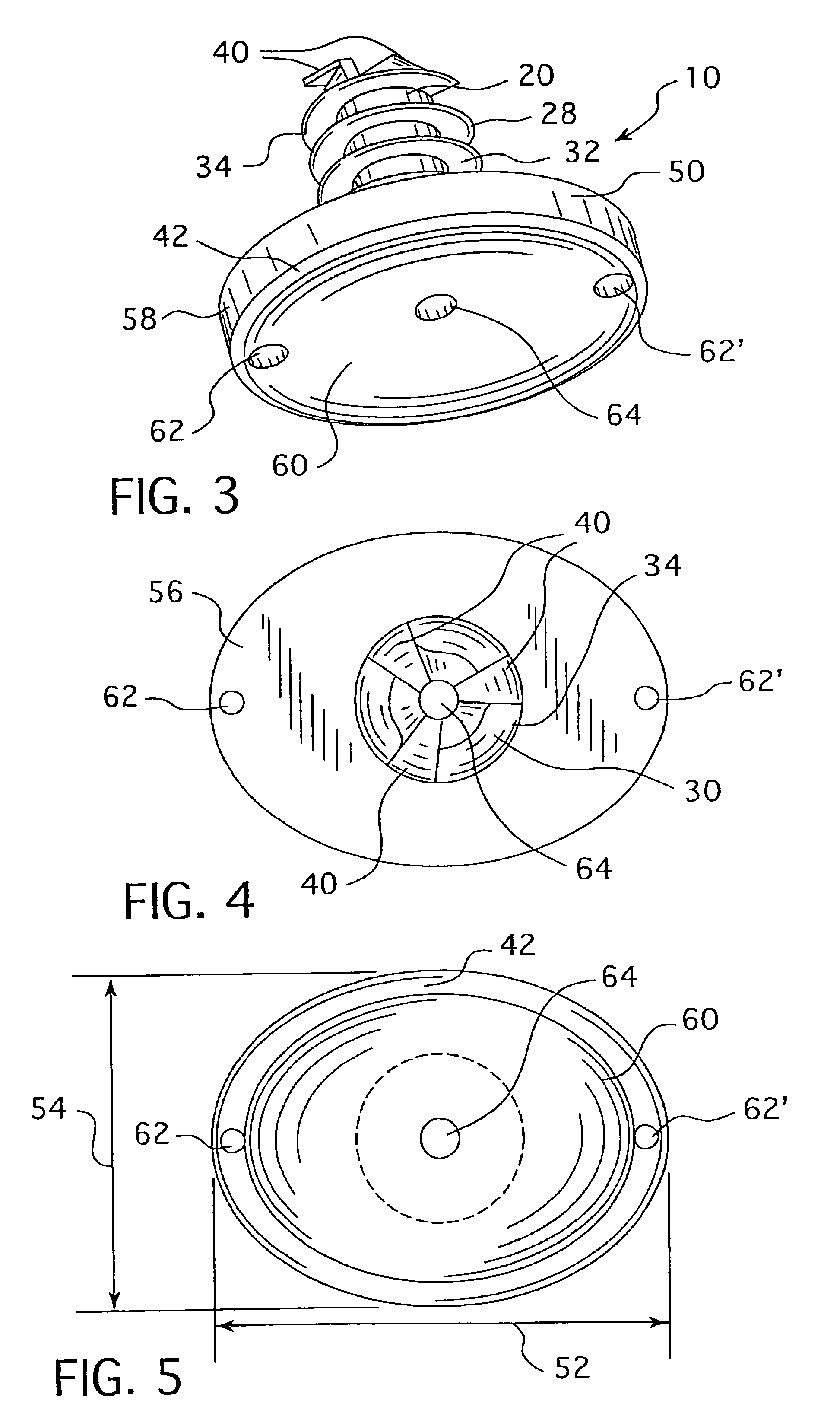 Cannulated hemi-implant and methods of use thereof