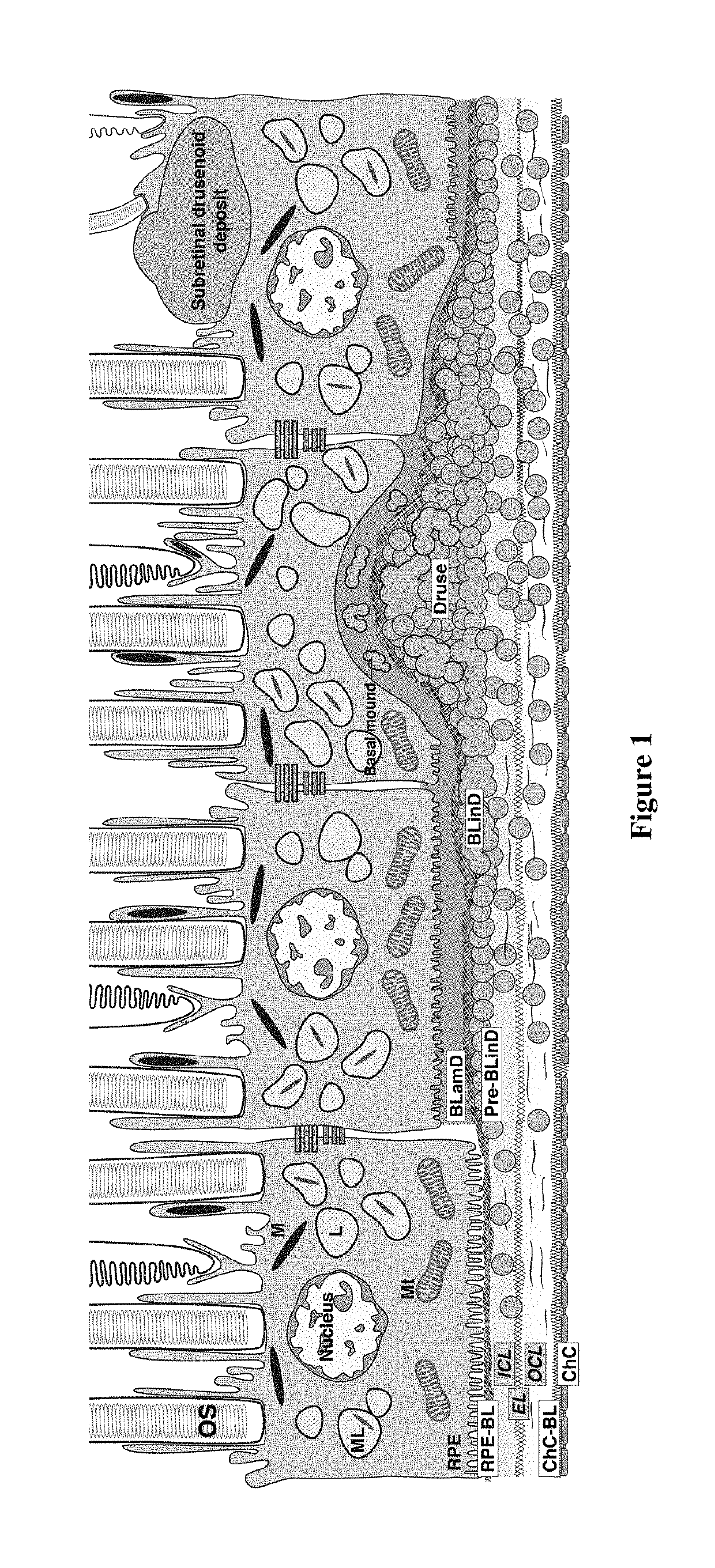 Treatment of age-related macular degeneration and other eye diseases with apolipoprotein mimetics