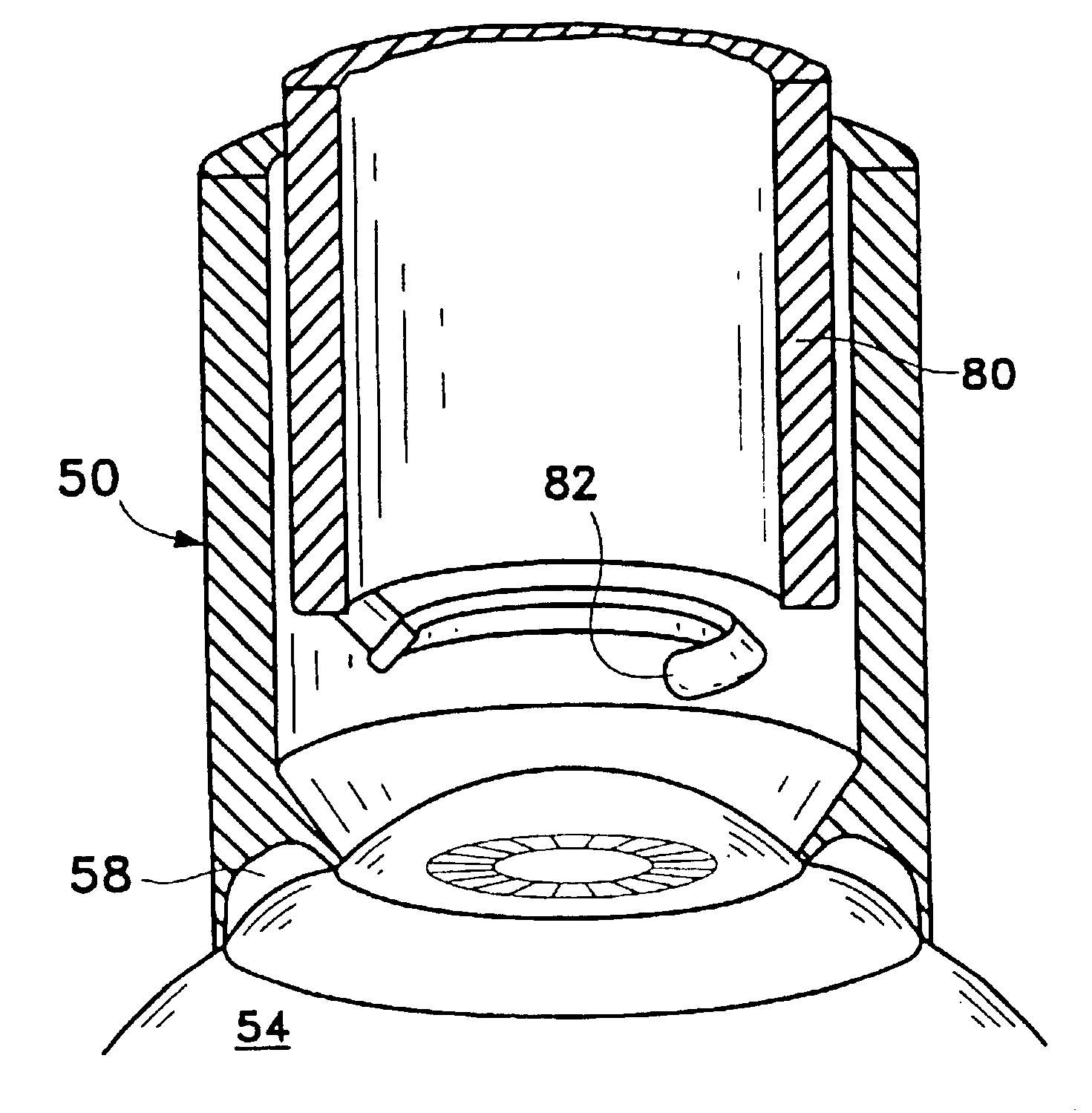 Device and method for inserting a biocompatible material into the corneal stroma