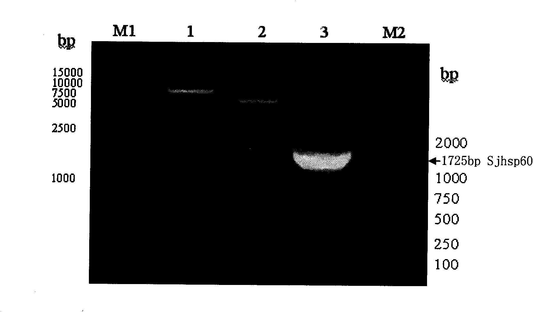 Recombinant expression carrier containing schistosoma japonicum gene and application thereof