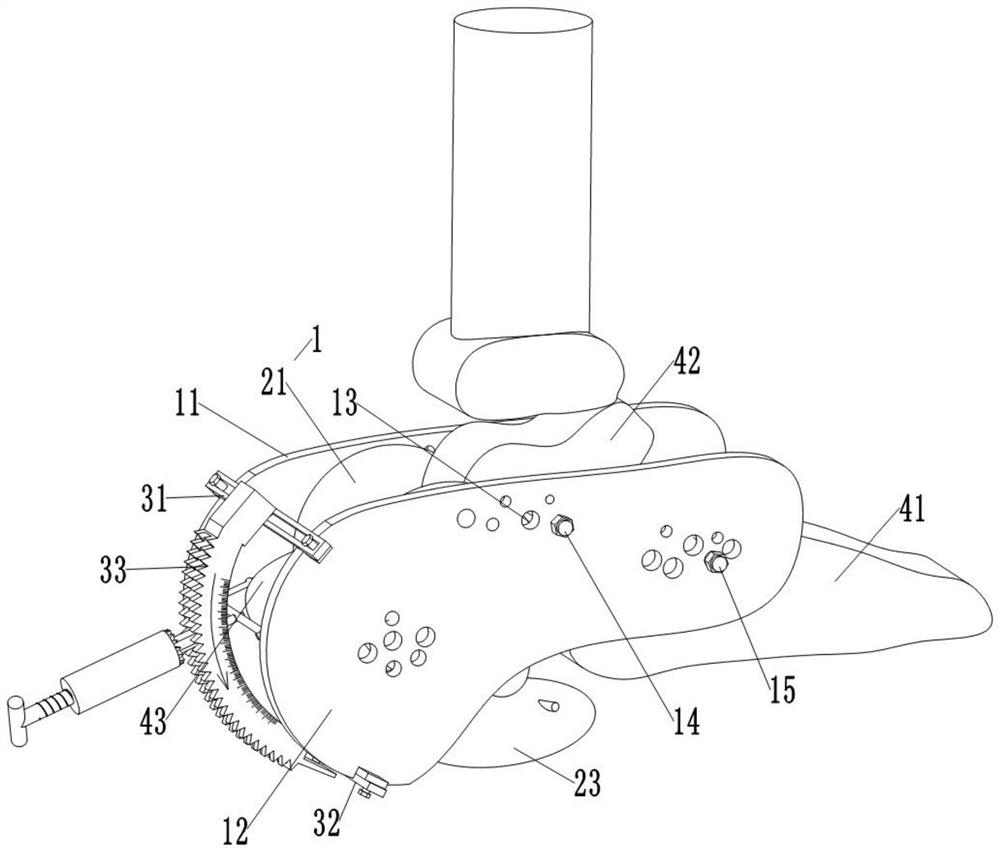 A closed reduction device for comminuted calcaneal fracture