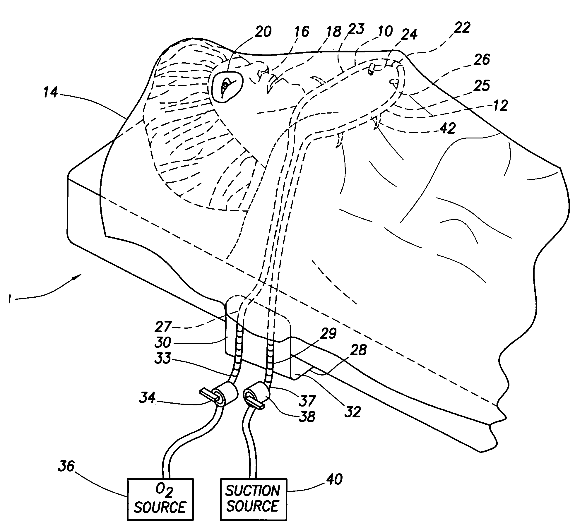 Ophthalmic surgical drape support