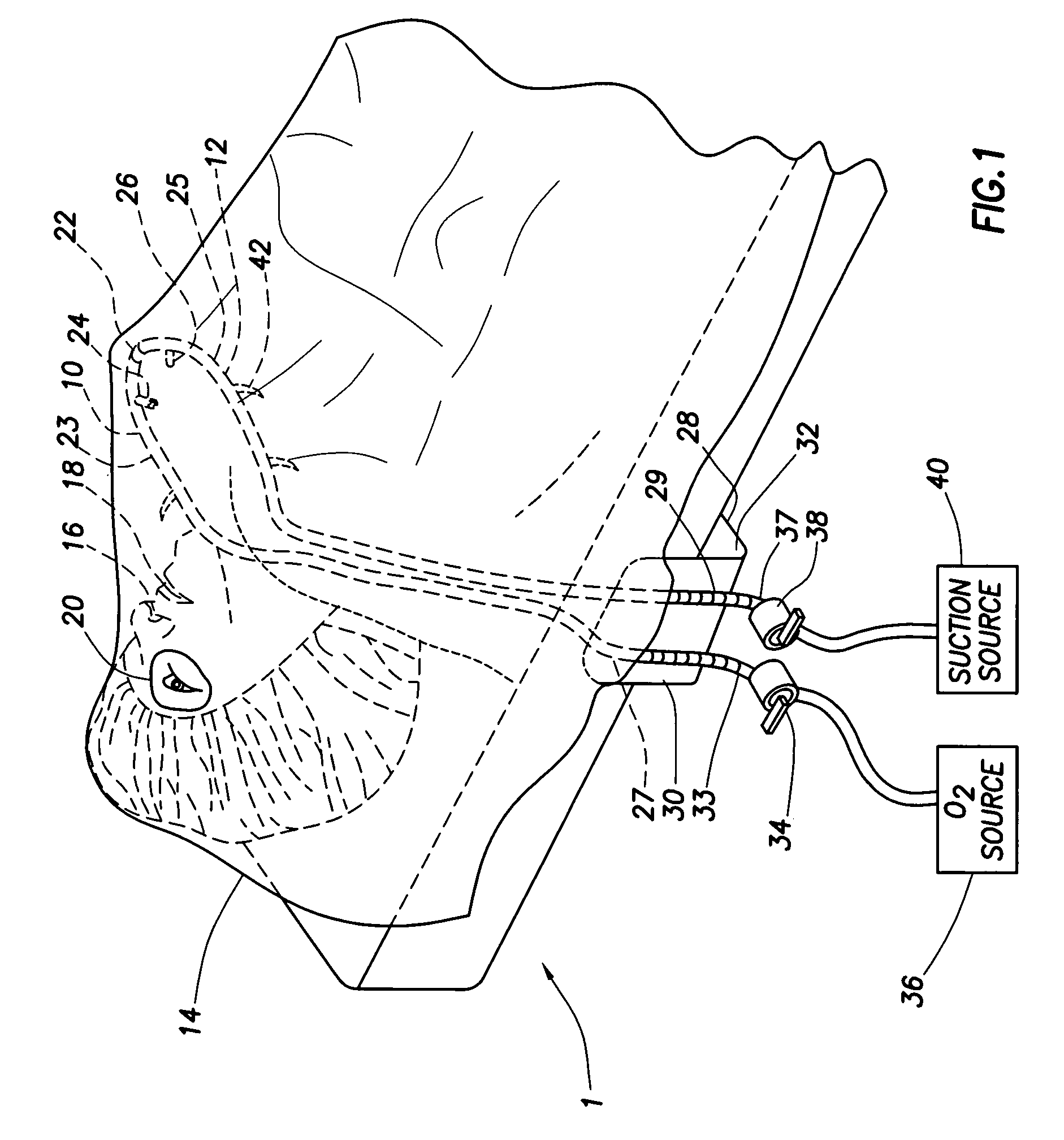 Ophthalmic surgical drape support