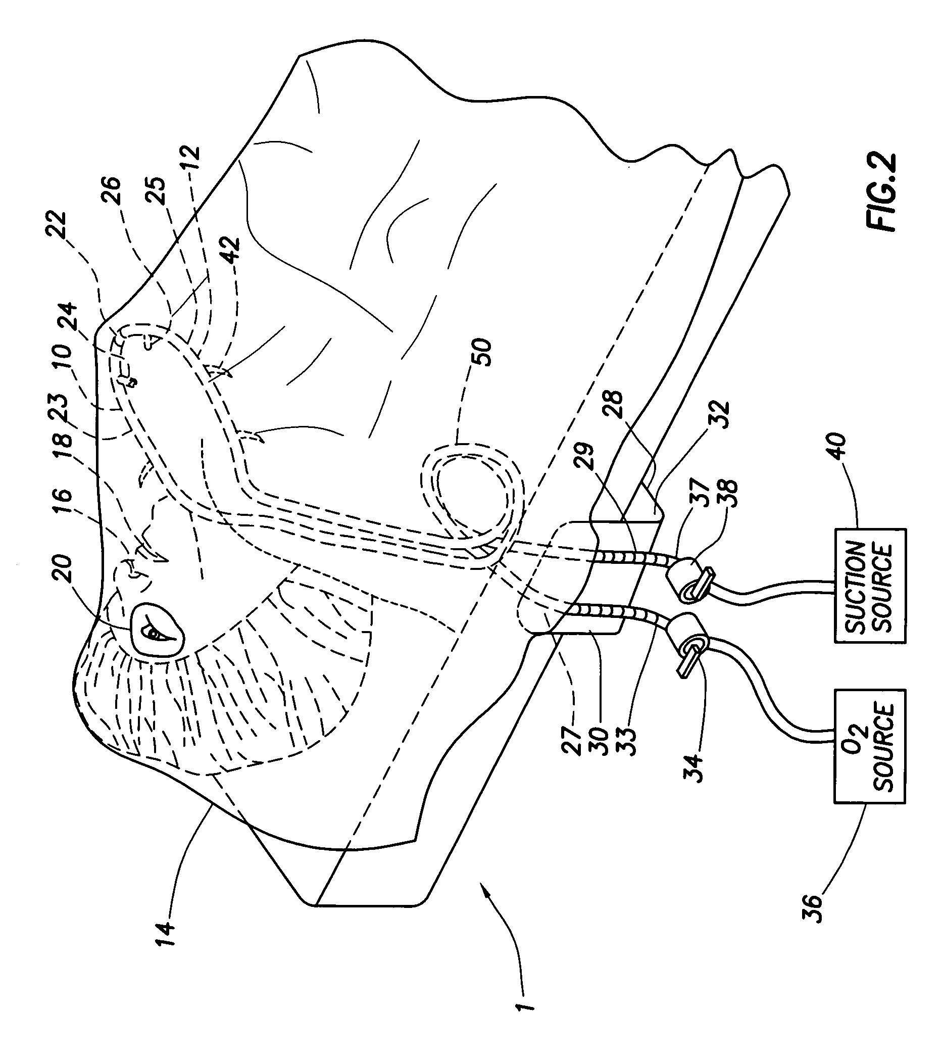 Ophthalmic surgical drape support