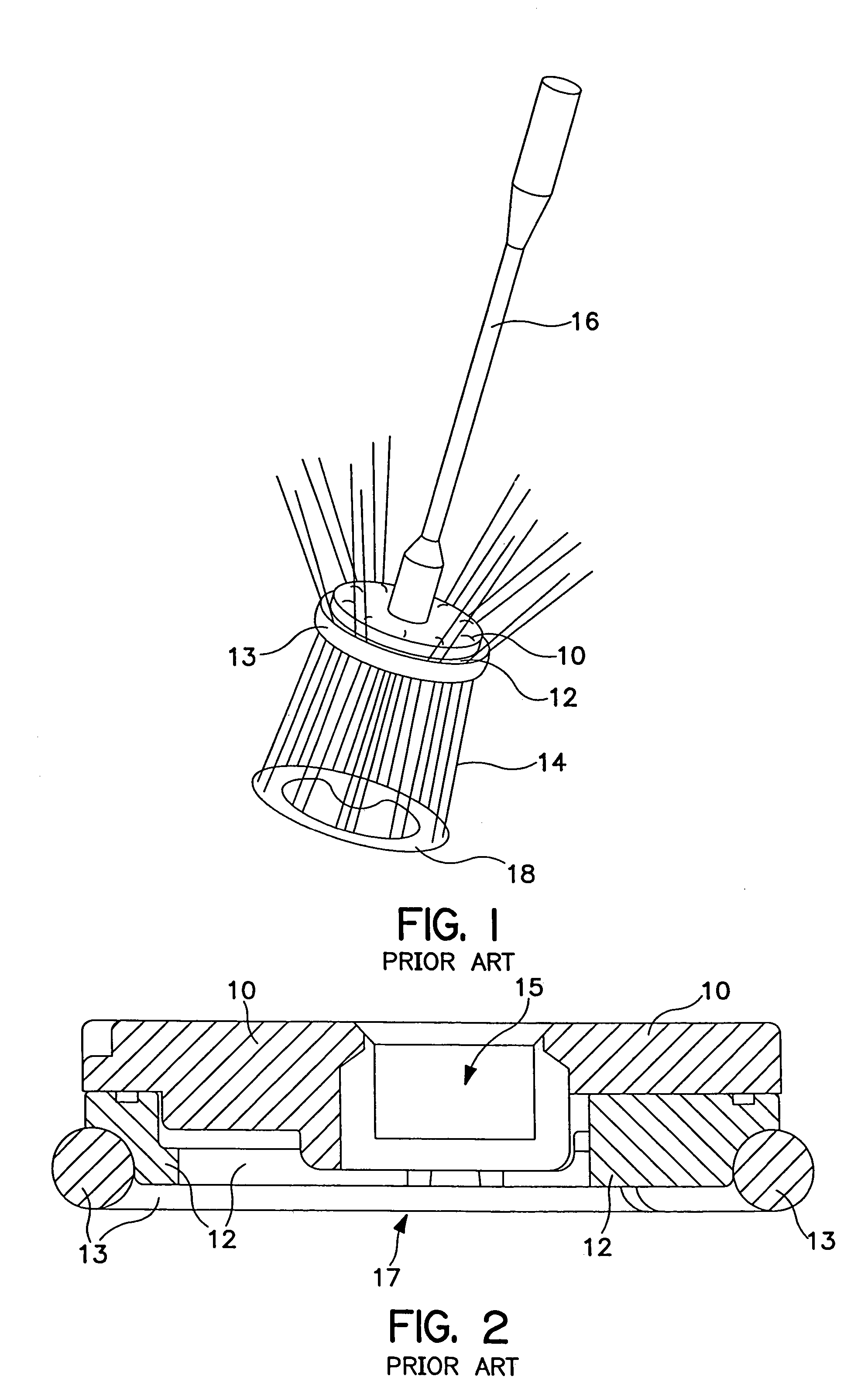 Annuloplasty system