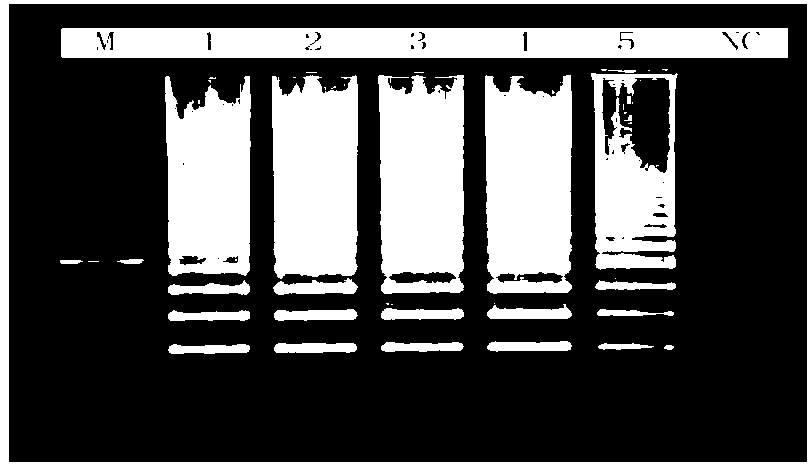 Loop-mediated isothermal amplification method for detecting lyme disease spirochete