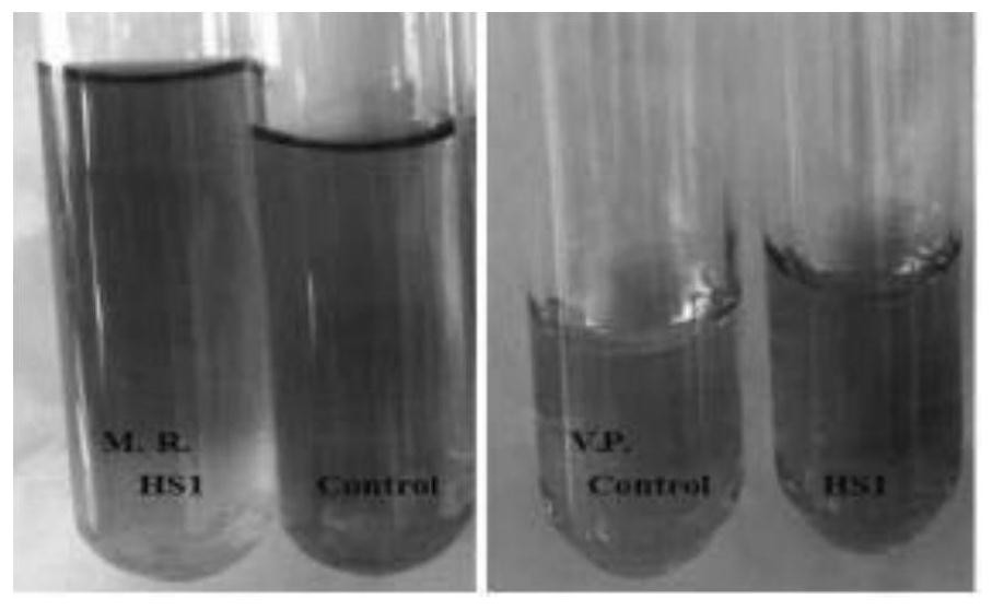 a Streptomyces