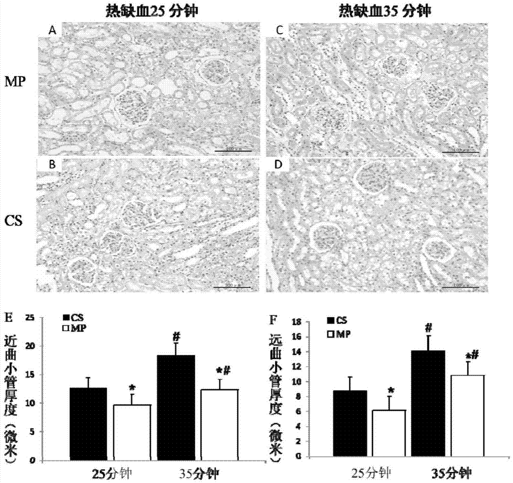 Rabbit kidney in-vivo low-temperature mechanical perfusion model and construction method thereof