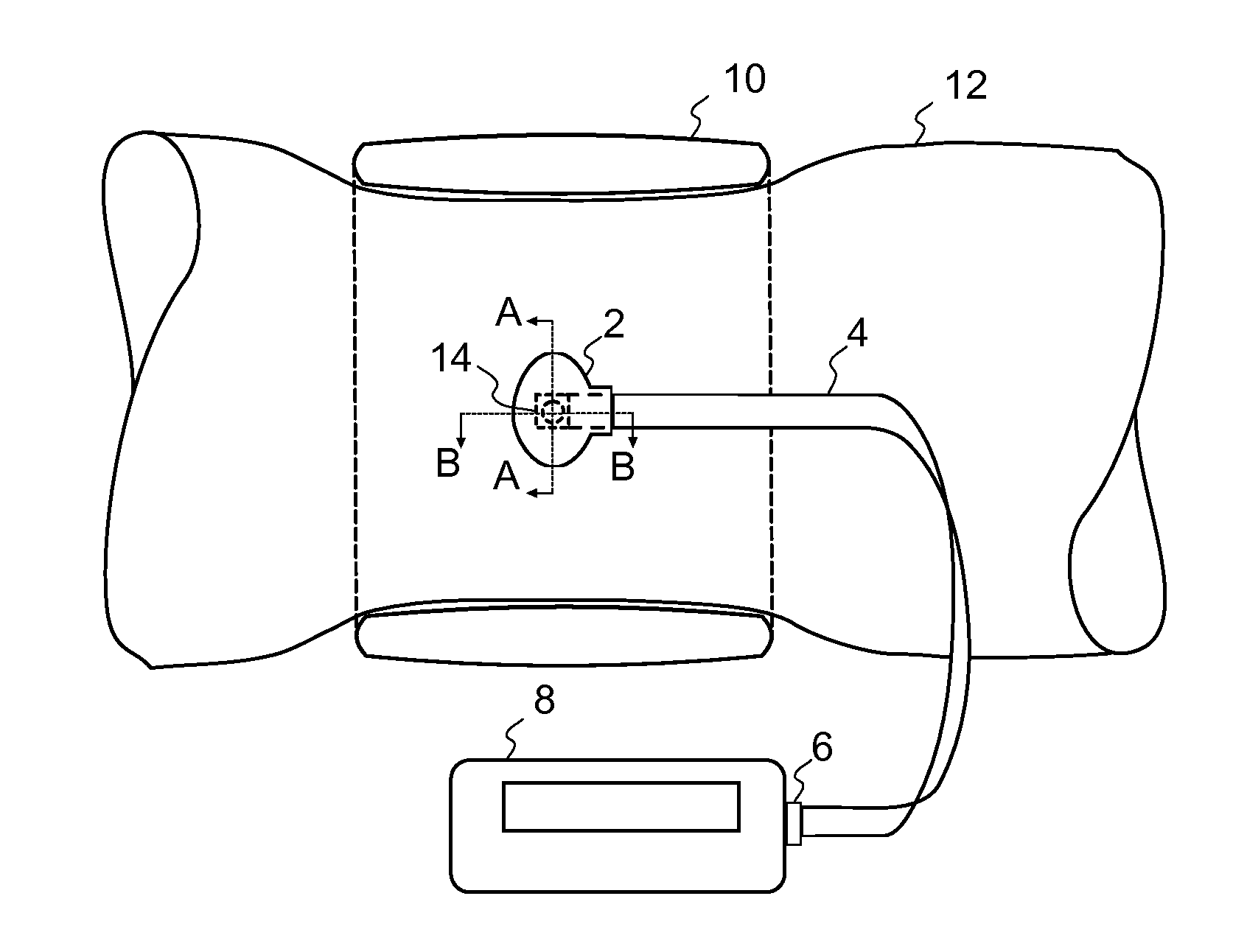 Biomedical Interface Pressure Transducer for Medical Tourniquets