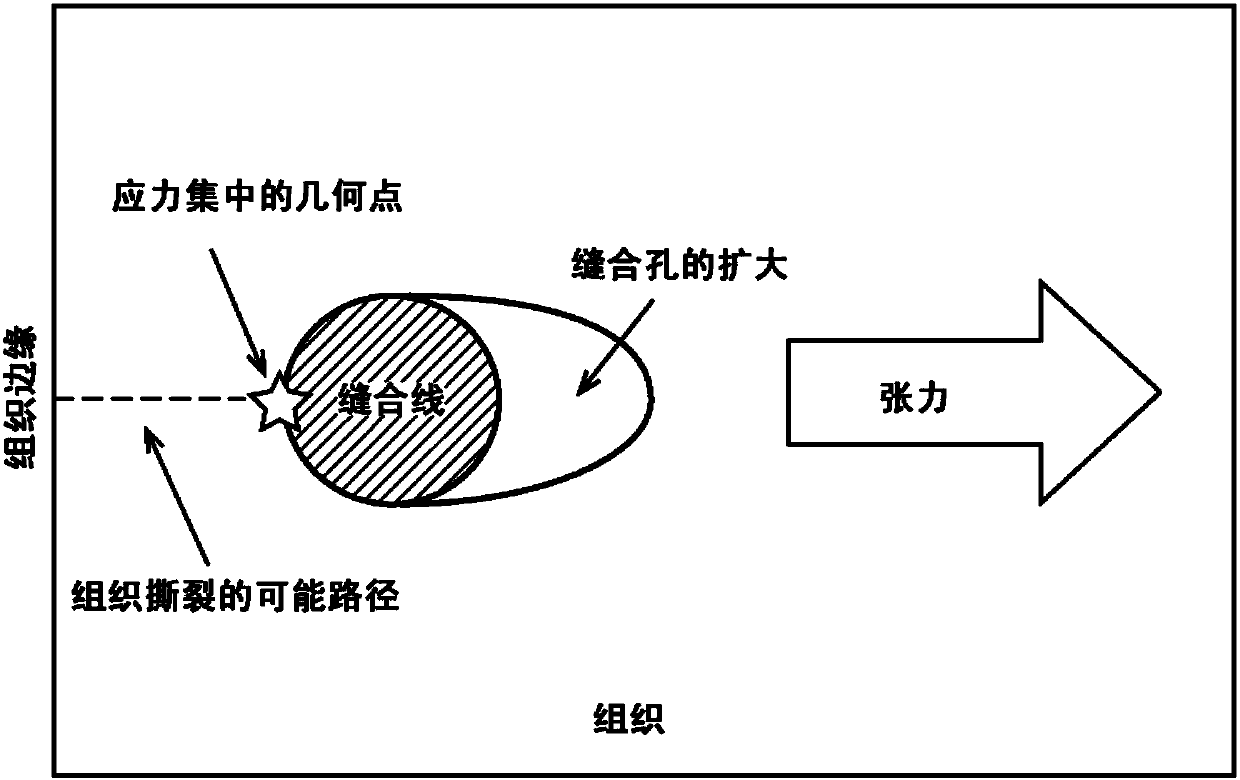 Improved suture