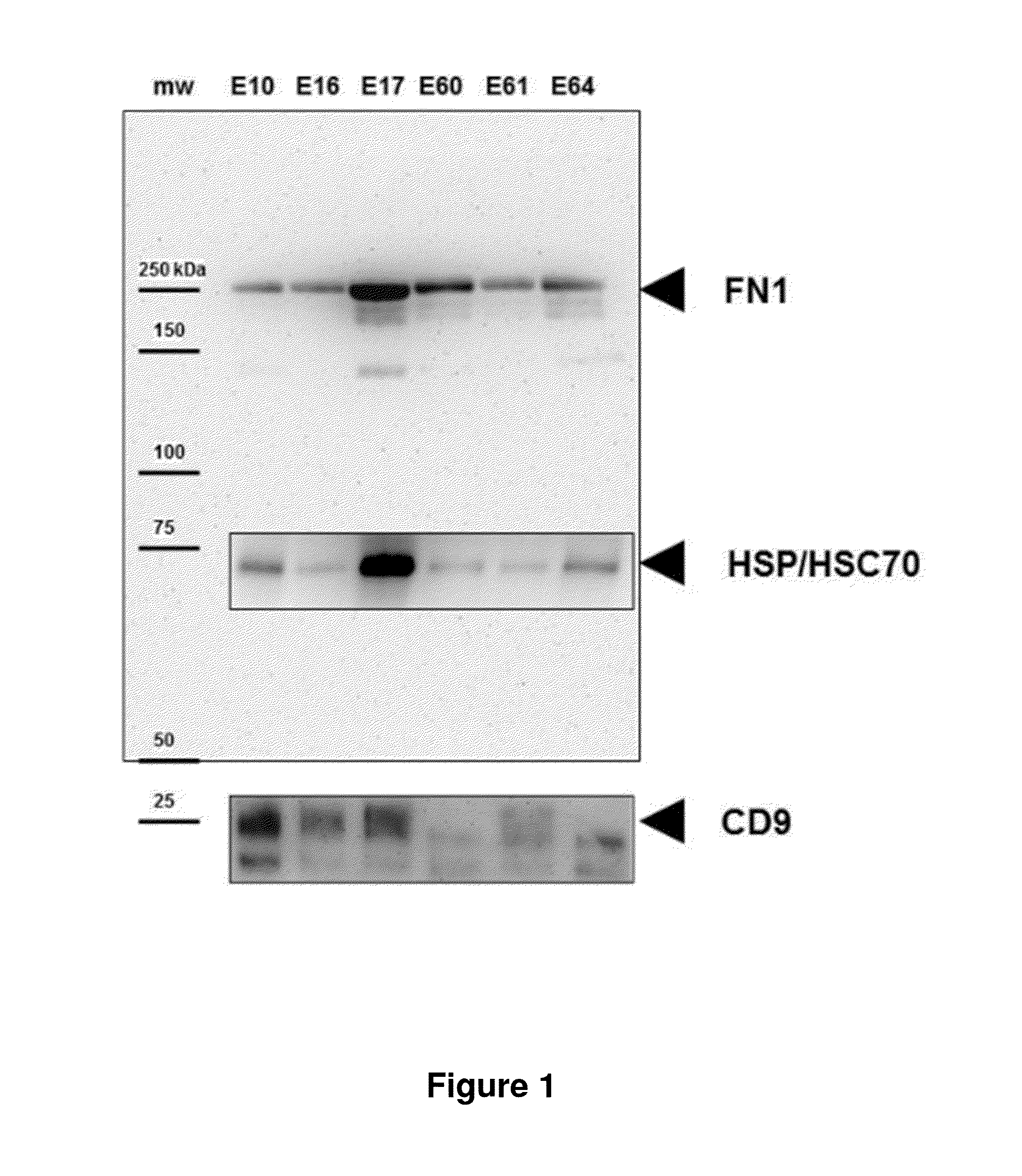 Biomarkers of preterm birth