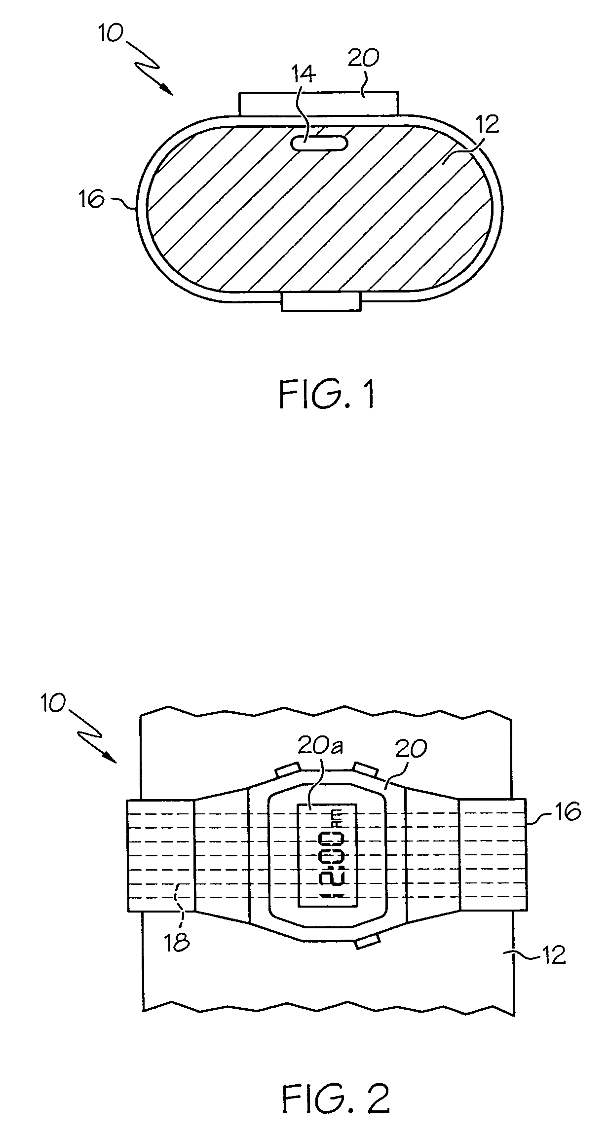 Wristband reader apparatus for human-implanted radio frequency identification device