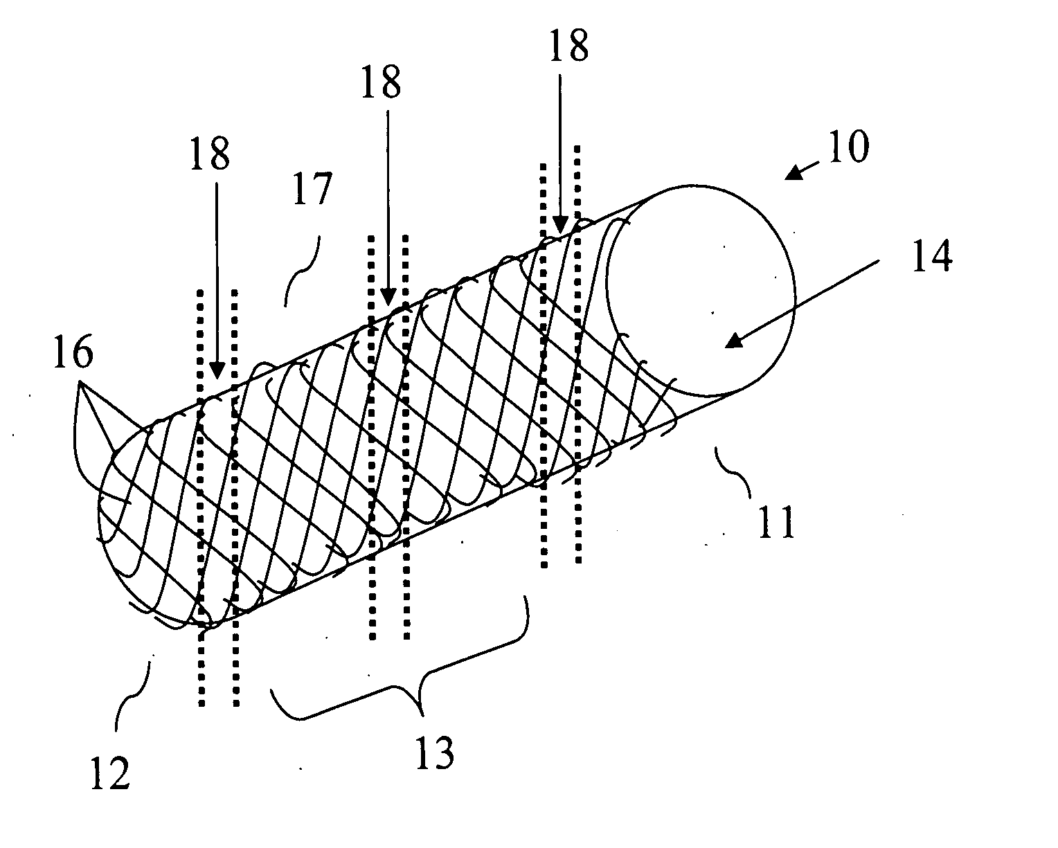 Biodegradable endovascular stent using stereocomplexation of polymers