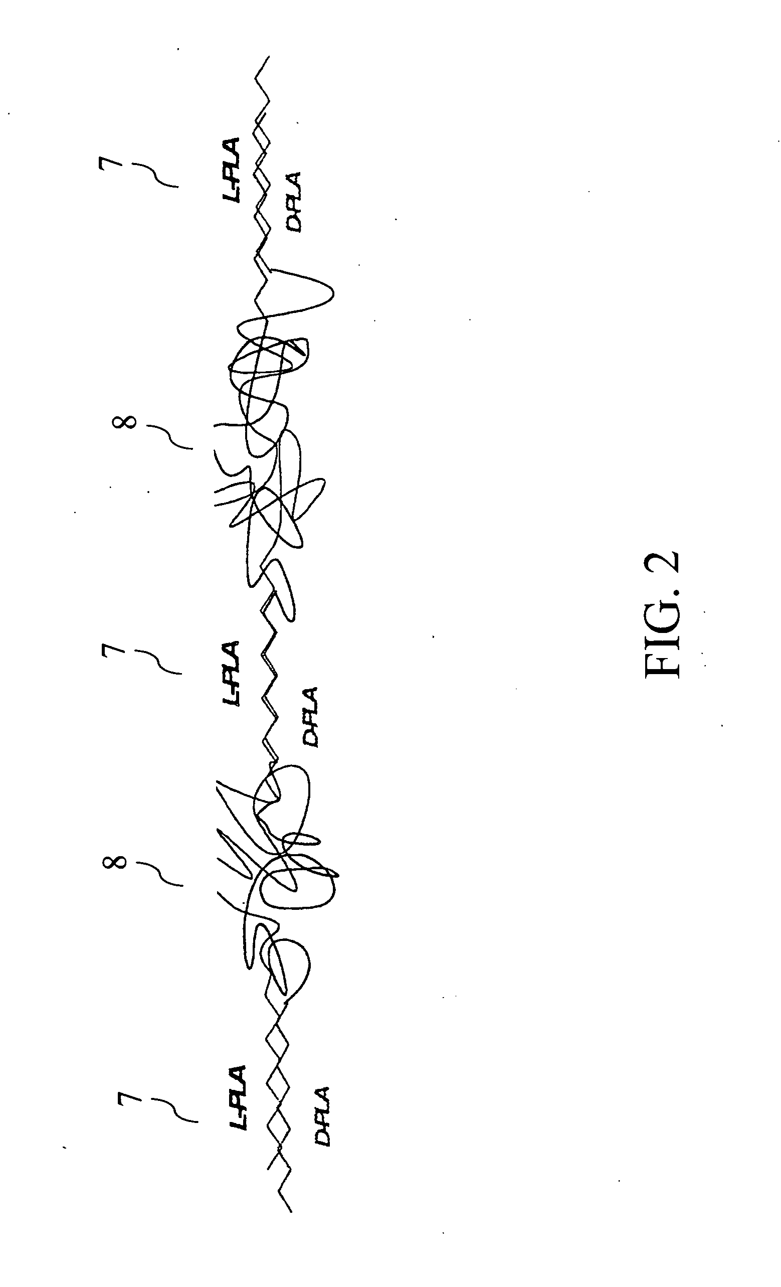 Biodegradable endovascular stent using stereocomplexation of polymers