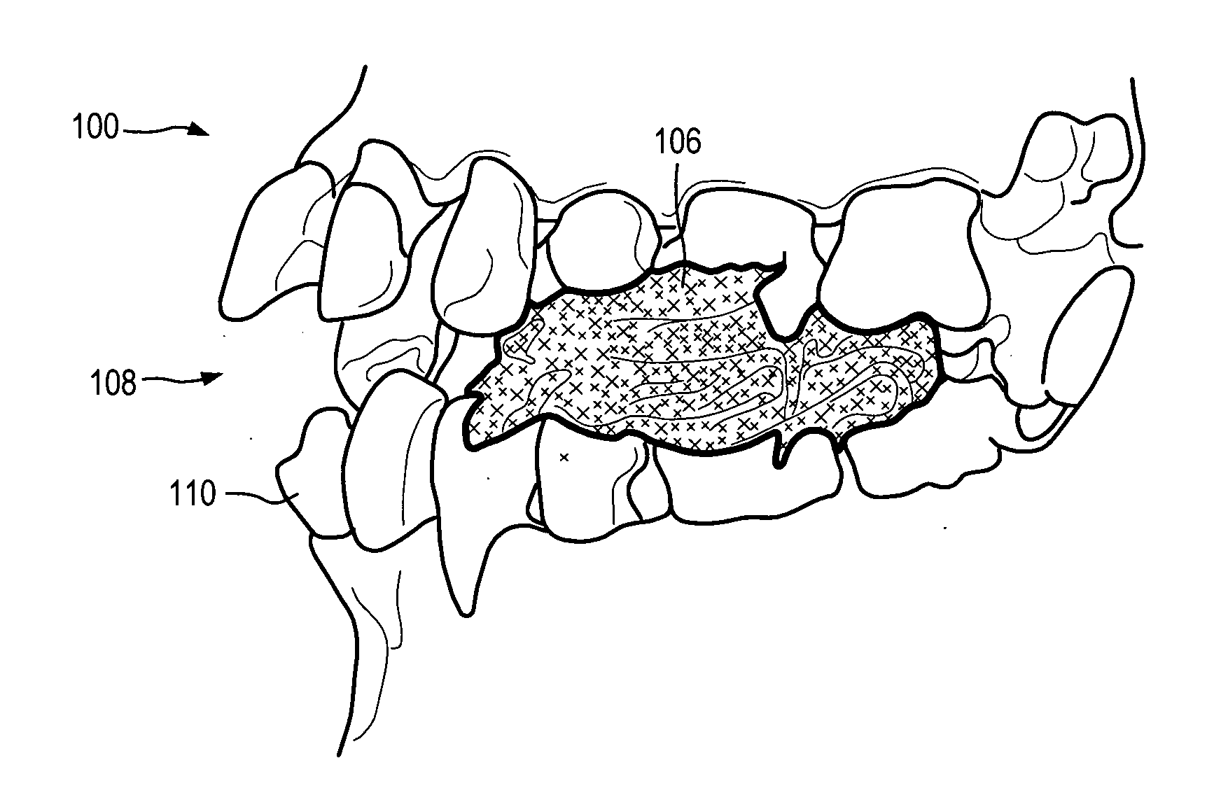 Anatomically-referenced fiducial marker for registration of data