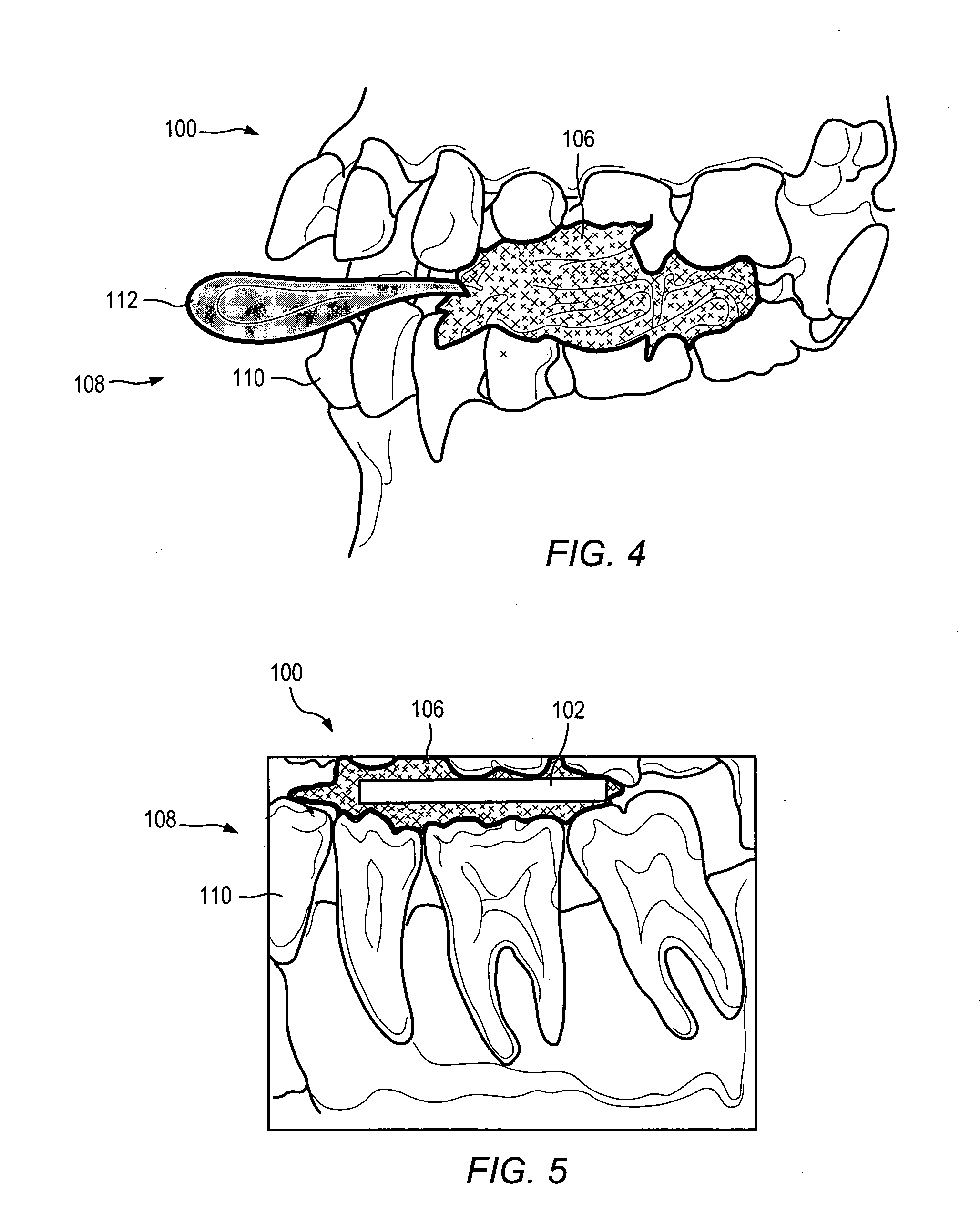 Anatomically-referenced fiducial marker for registration of data