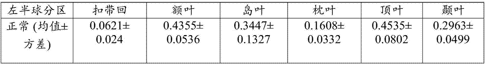 Quantitative calculation method for automatic regional brain shrinkage degree