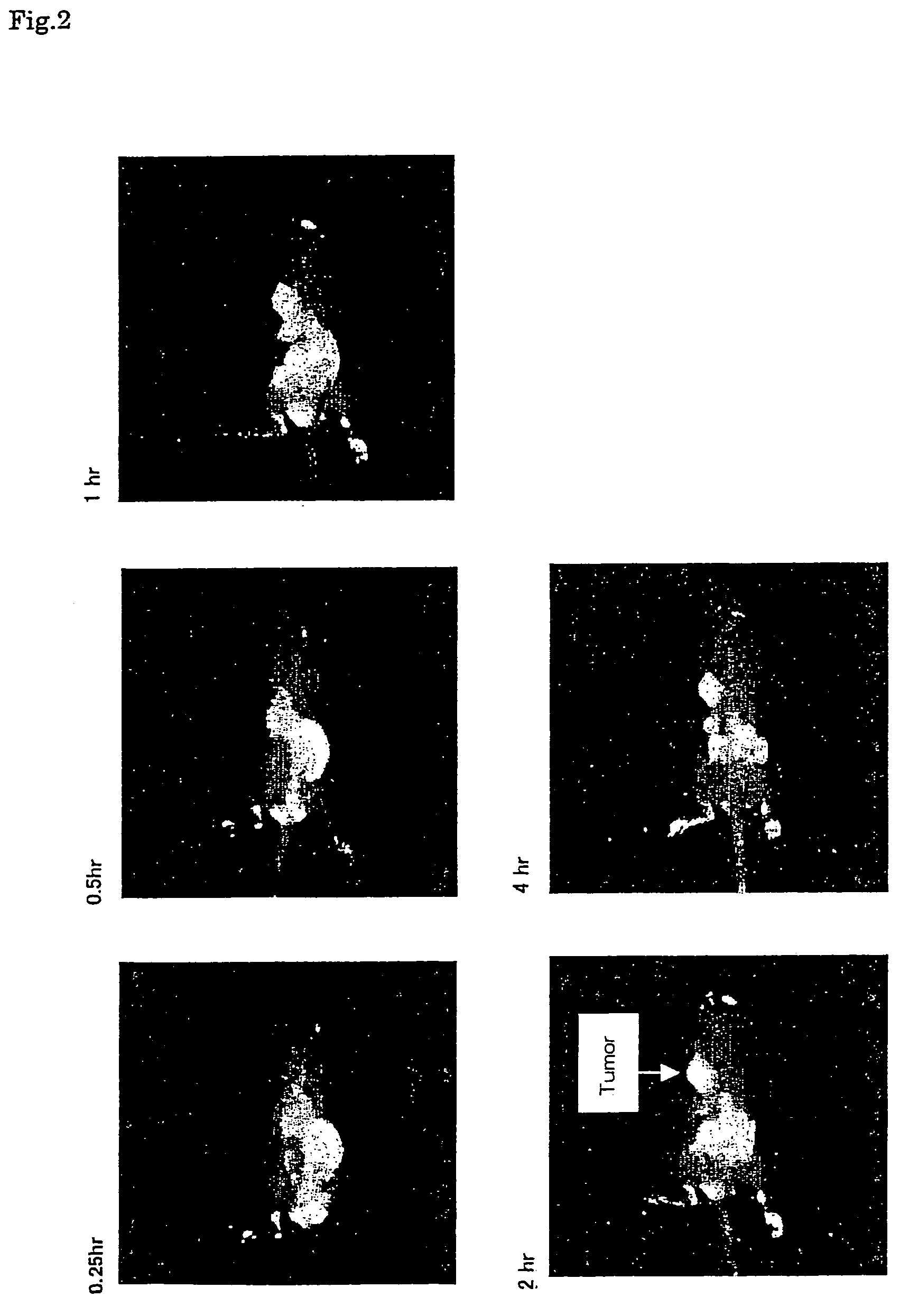 Near infrared fluorescent contrast agent and method for fluorescence imaging