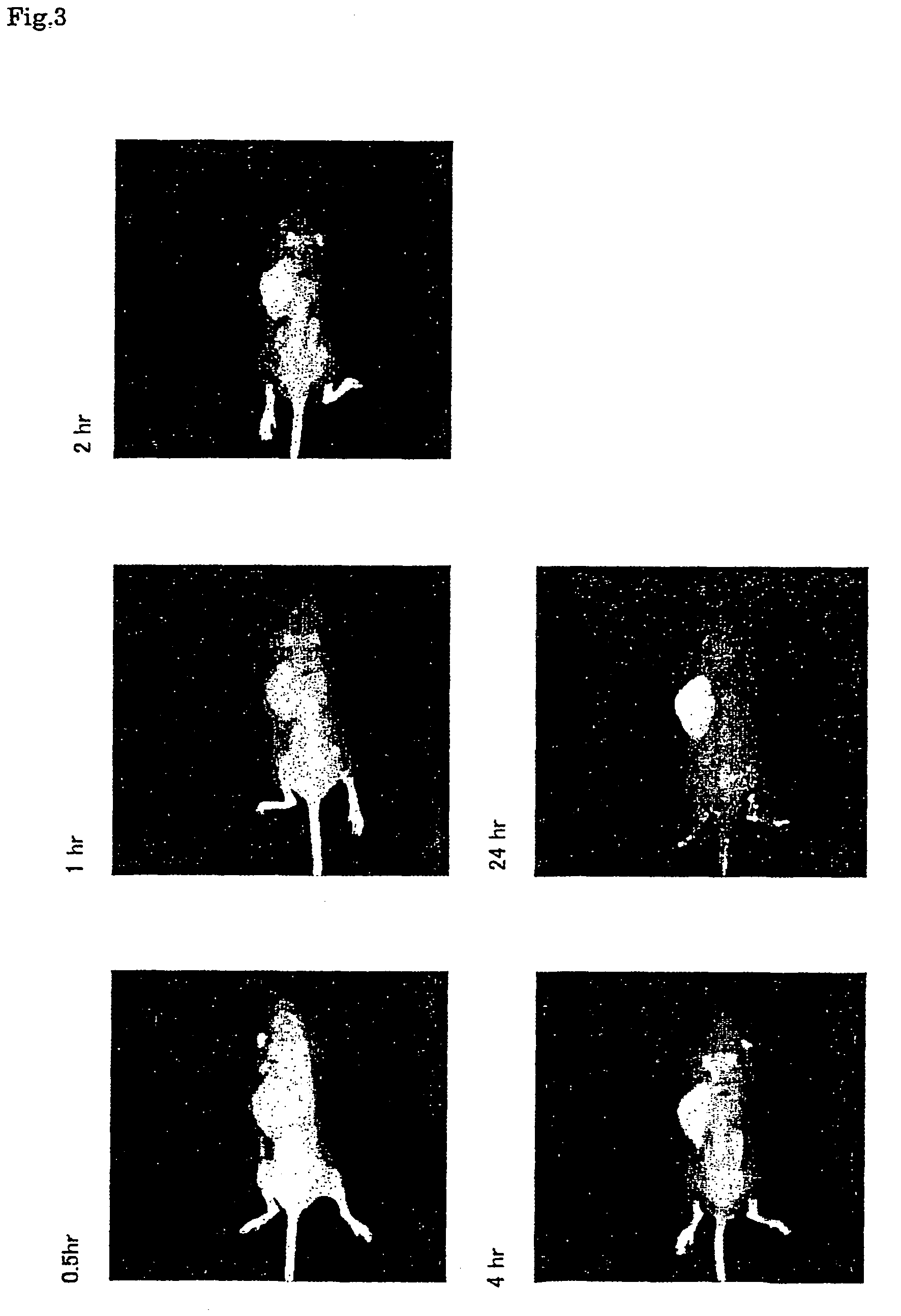 Near infrared fluorescent contrast agent and method for fluorescence imaging