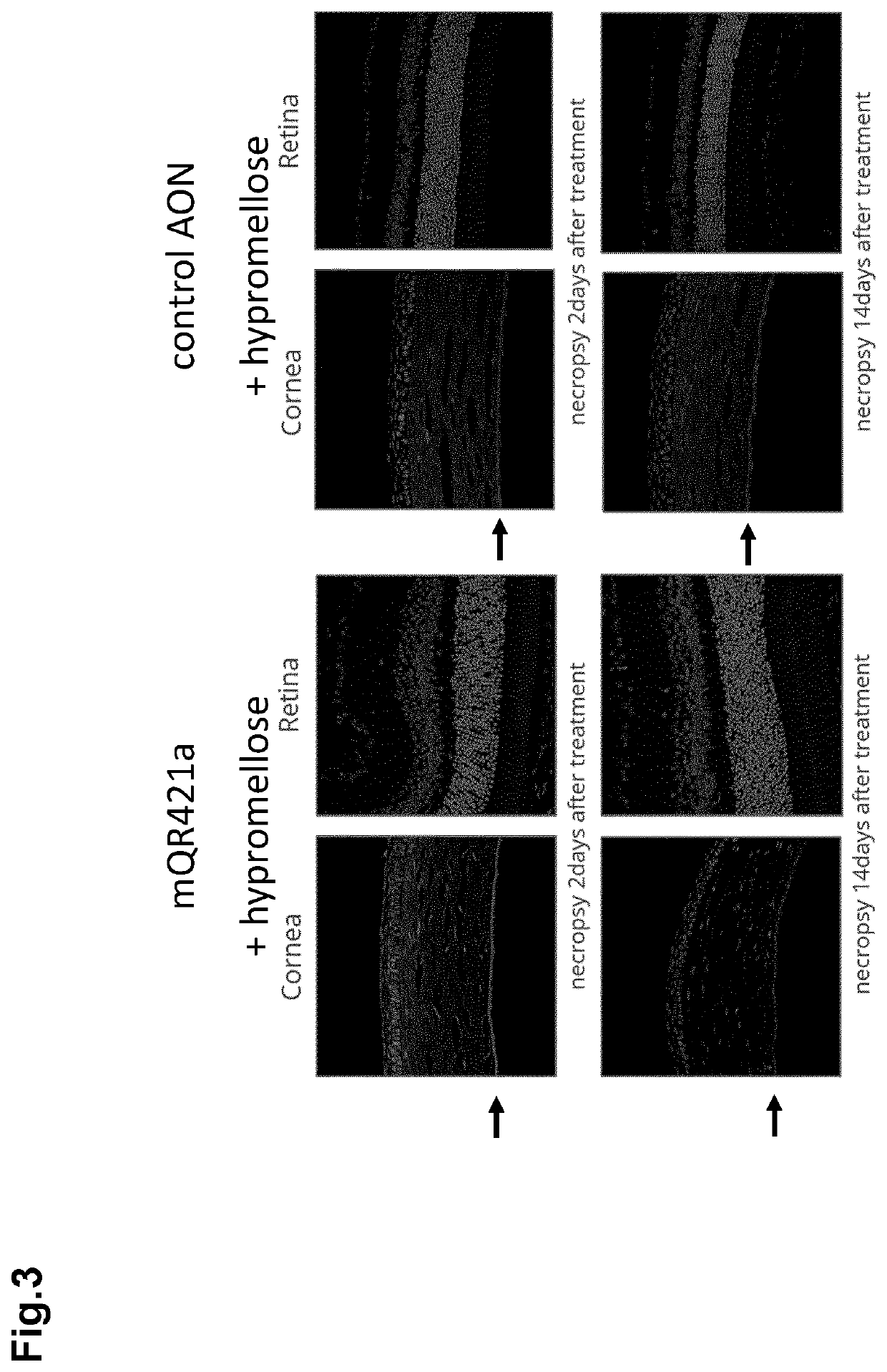 Opthalmic compositions comprising viscosifying polymers and nucleic acids