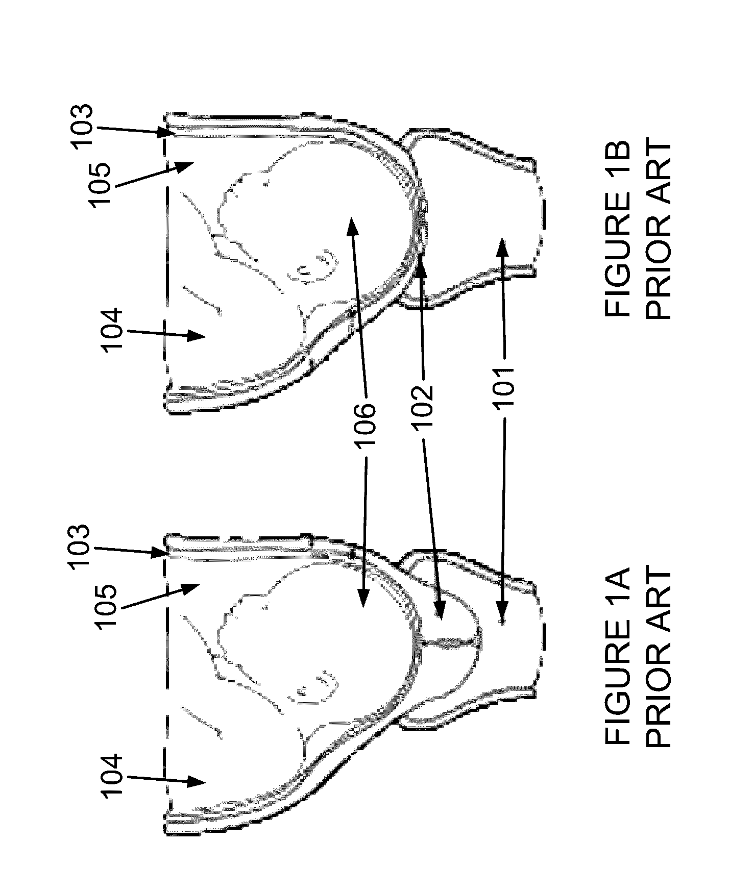 Delaying pre-term birth