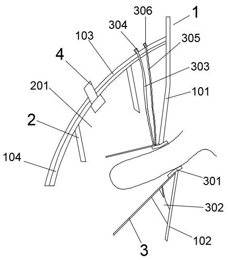 A concealed male urethritis sterilization treatment device