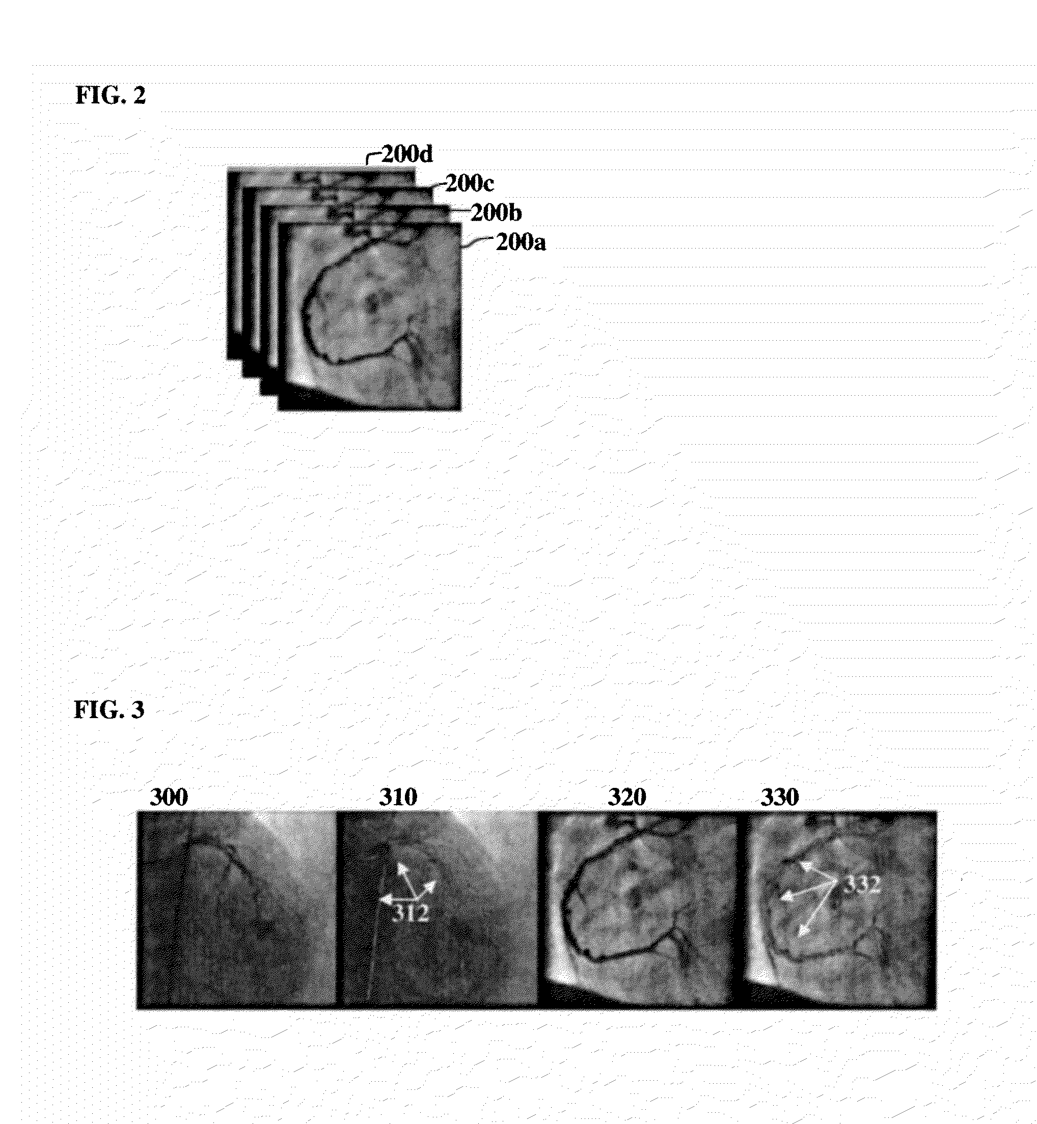 Method and system for contrast inflow detection in 2D fluoroscopic images