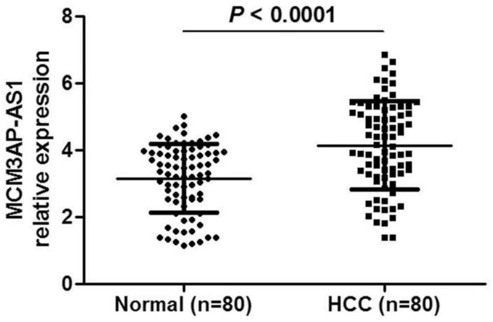 Long-chain non-coding RNA and application thereof in diagnosis and treatment of hepatocellular carcinoma