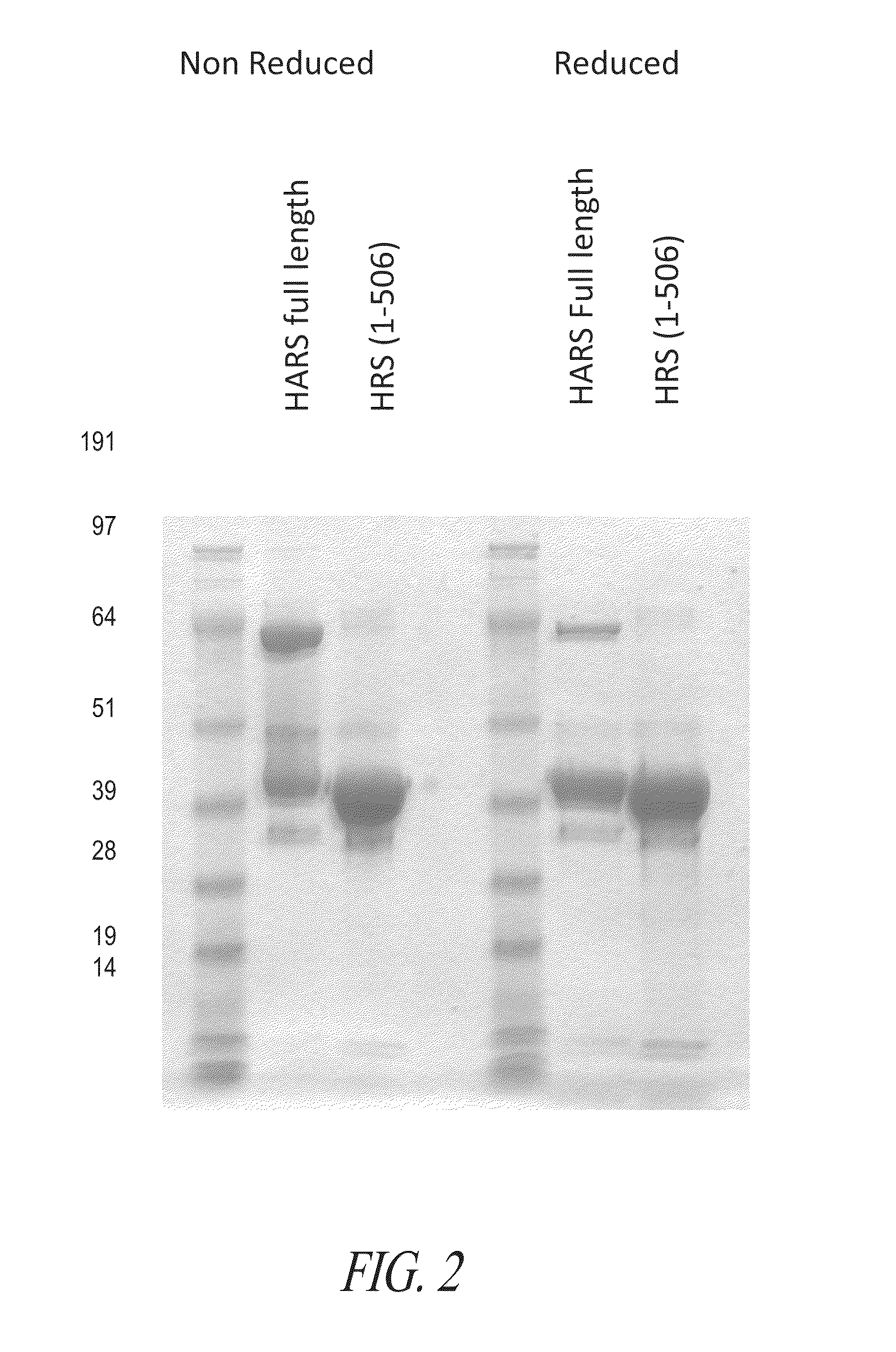 Histidyl-tRNA synthetases for treating autoimmune and inflammatory diseases