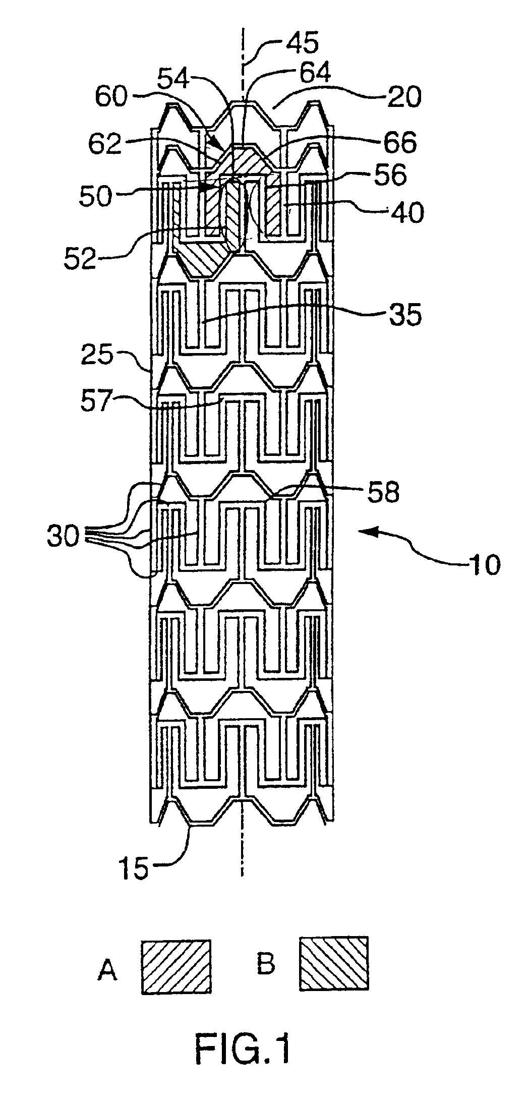 Expandable stent and method for delivery of same