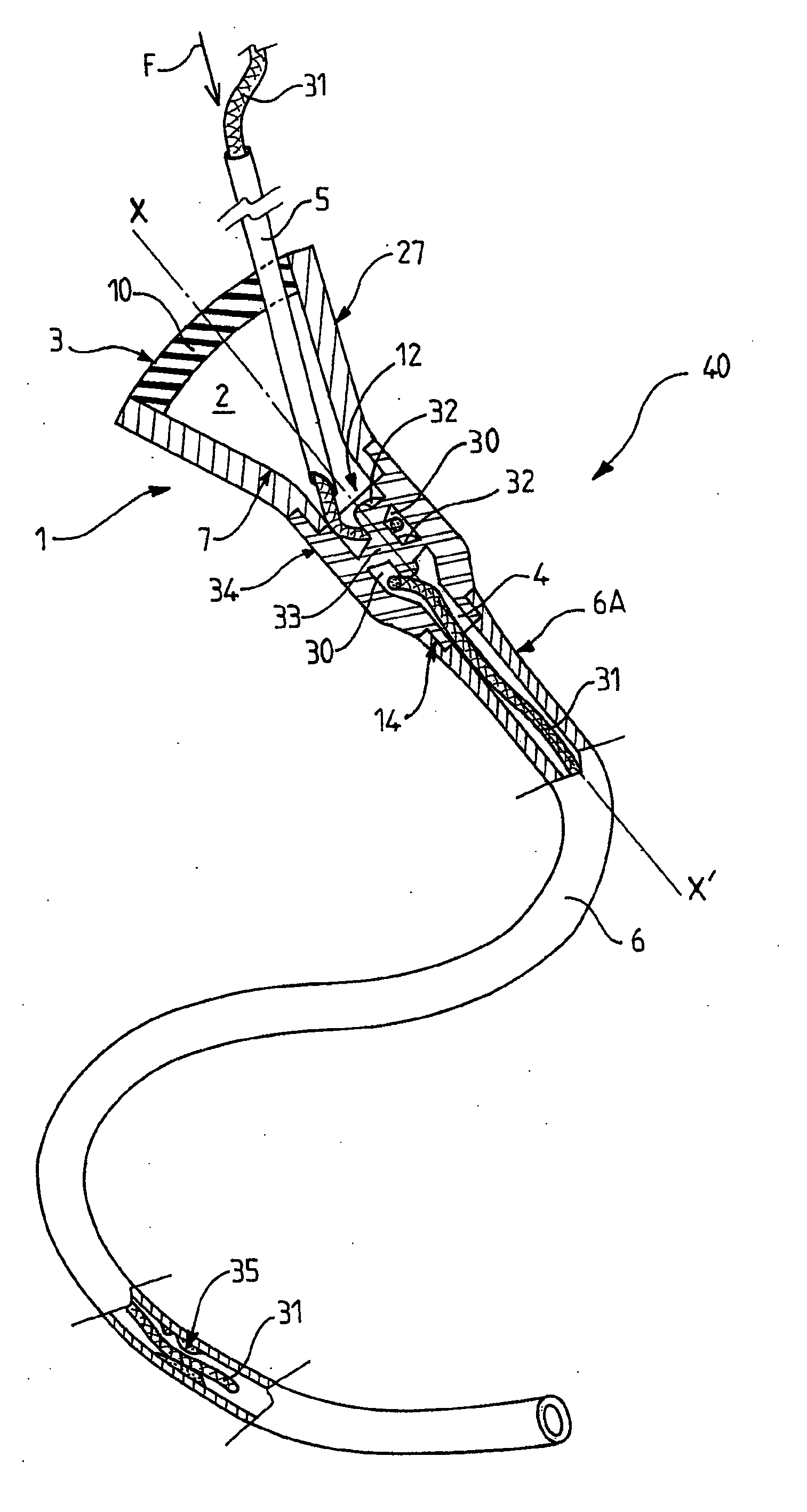 Compact linear implantable site